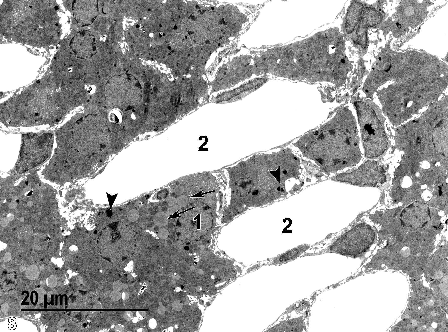 Image of a low magnification view of the zona reticularis showing a nucleus, lipid droplets, capillaries, and lysosomes.