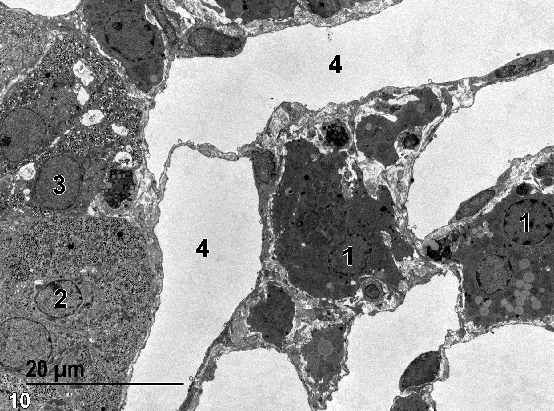Image of two zona reticularis cells, an epinephrine medullary cell, and a norepinephrine medullary cell.