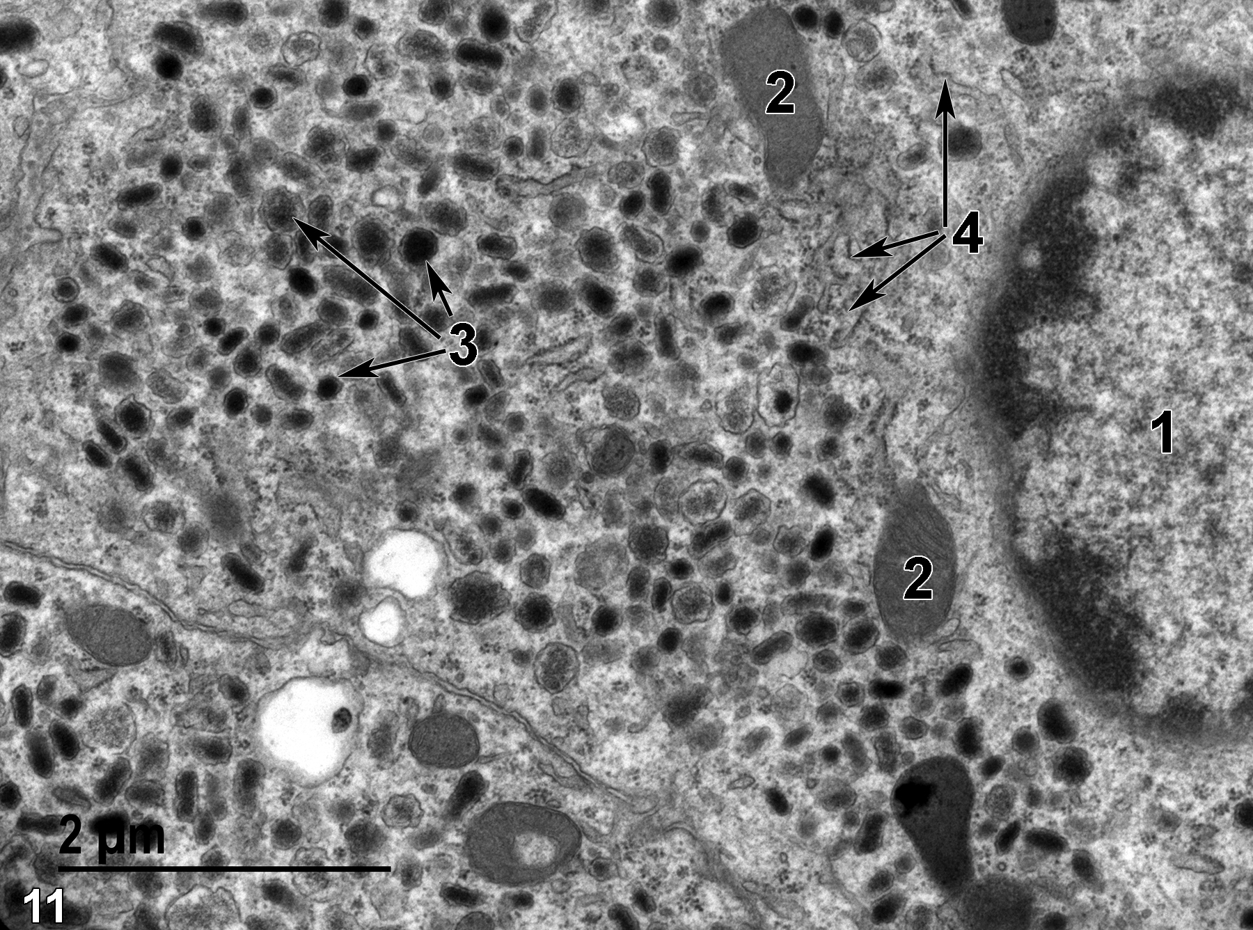 <strong>Figure 11.</strong> A high magnification view of an epinephrine cell of the medulla with a single nucleus (1), some mitochondria (2), a large number of variably sized secretory granules with variable electron-dense contents (3, arrows), and some profiles of rough endoplasmic reticulum (4, arrows). Aggregates of particulate glycogen and free ribosomes are scattered throughout the cytoplasm. 18500x.