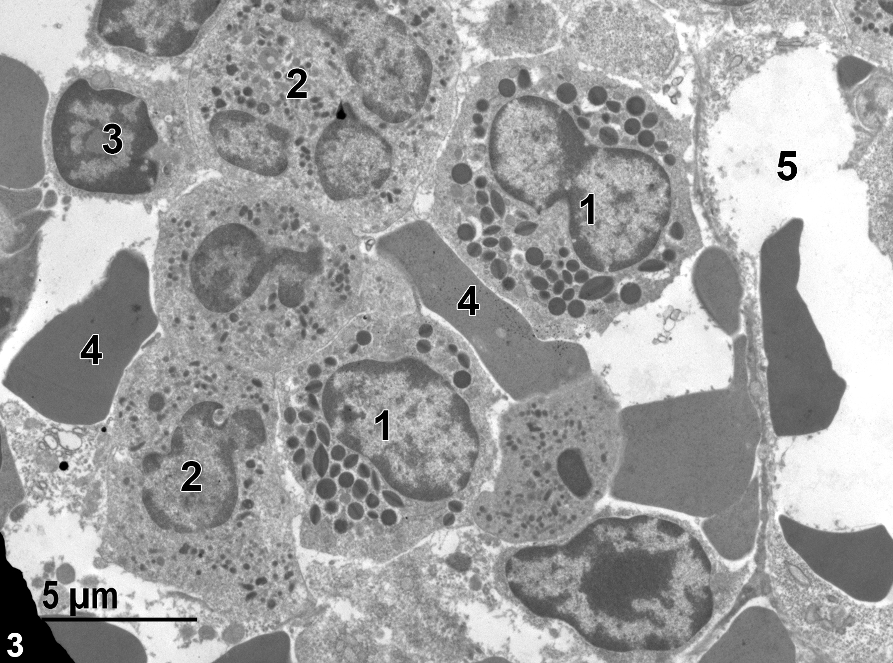 <strong>Figure 3.</strong> A higher magnification view of marrow structures, including eosinophils (1) with characteristic elliptical granules with linear inclusions, neutrophils (2) with prominent lobed nuclei and three different populations of specific granules, an erythroblast (3) with characteristic nuclei with large amounts of heterochromatin and relatively sparse cytoplasm, erythrocytes (4), and a capillary (5) that contains erythrocytes. 4800x.