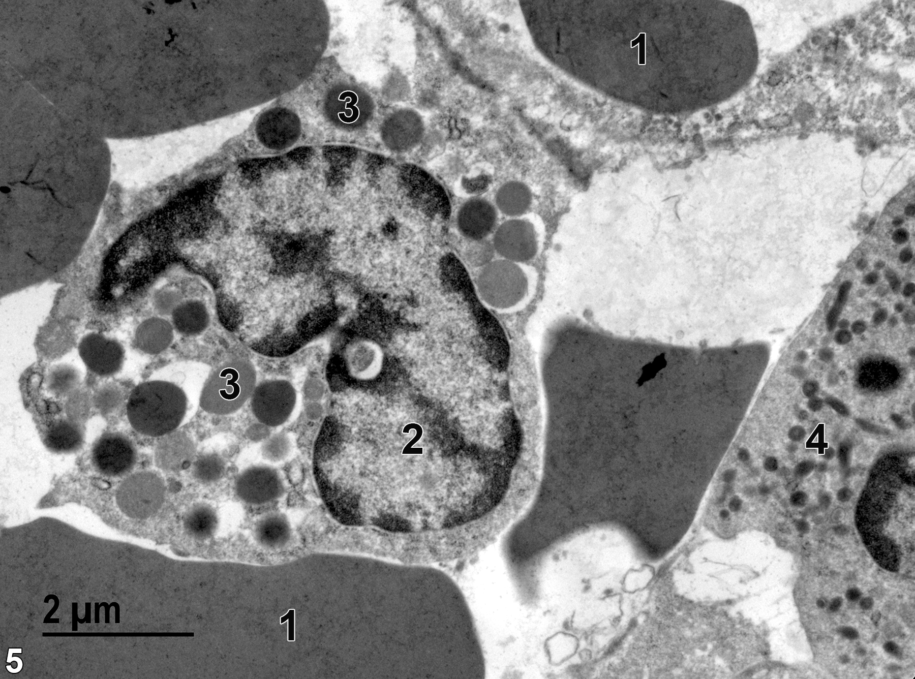 <strong>Figure 5.</strong> Several erythrocytes (1) and a relatively rare basophil (2) with relatively large and variably sized basophilic granules of varying electron density (3). A neutrophil with elongated granules (4), spherical electron-dense granules, and smaller more electron-lucent granules is located at the lower right of the image. 11000x.