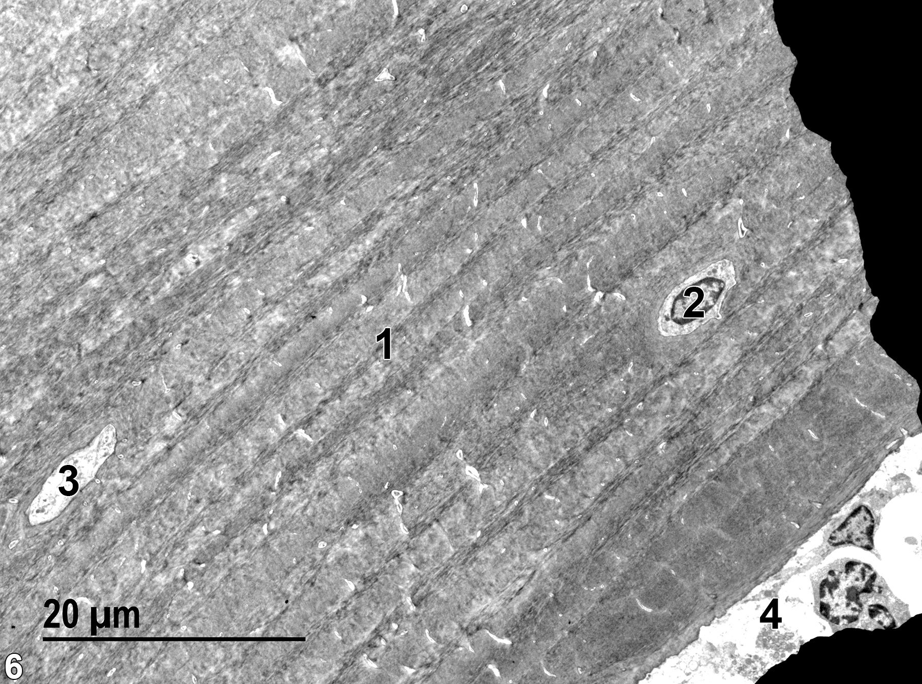 <strong>Figure 6.</strong> A low magnification view of cortical bone, showing the lamellar structure of the bone matrix (1), with a single Howship’s lacuna (2) containing an osteocyte. The dark areas at the right of the image are grid bars blocking the electron beam. A portion of a Haversian canal (3) is oriented parallel to the long axis of the bone. The edge of the bone marrow (4). 1900x.