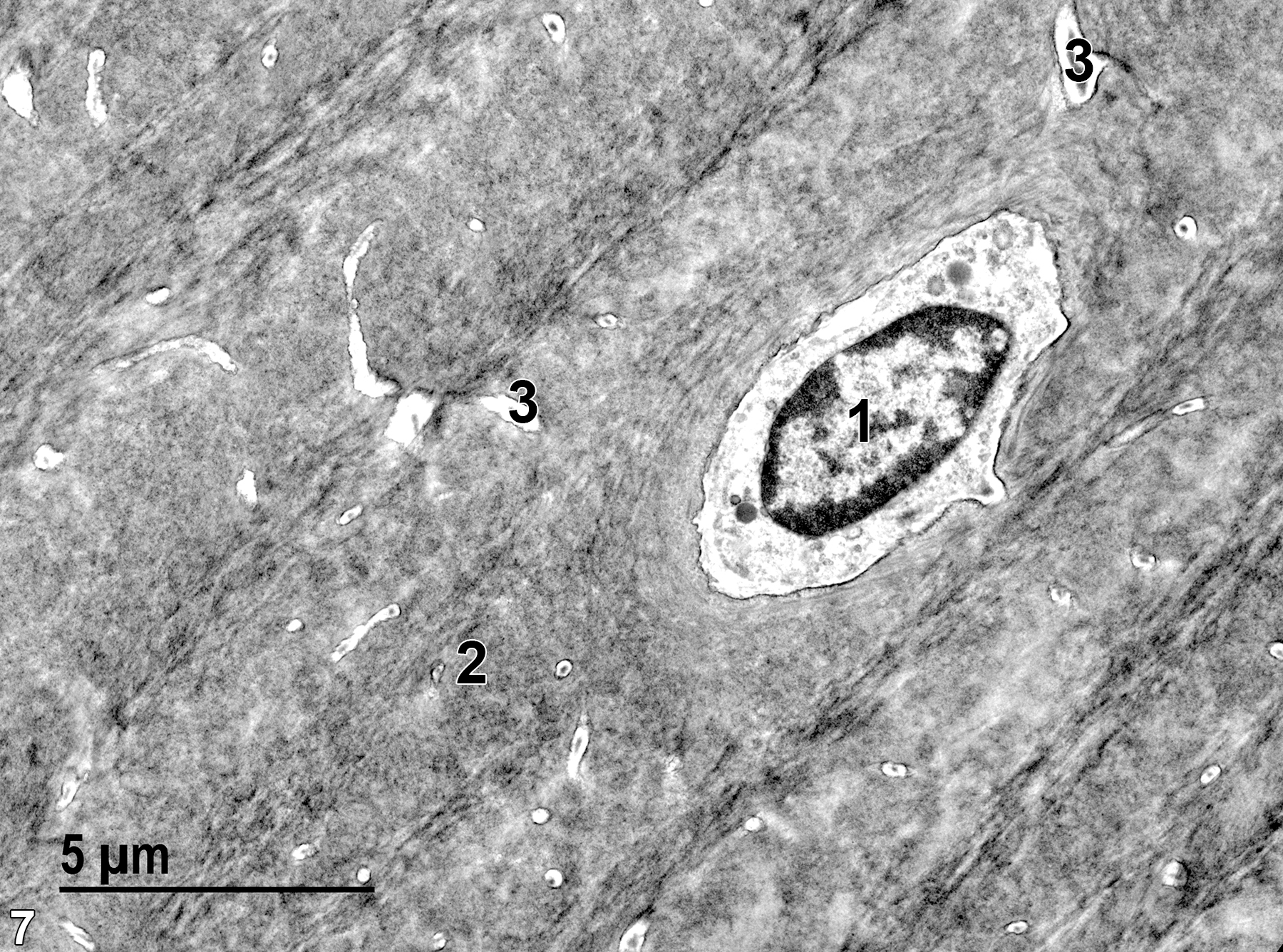 <strong>Figure 7.</strong> An enlarged view of Figure 6. The nucleus of an osteocyte (1) is surrounded by poorly preserved cytoplasm because of the decalcification procedure necessary to allow sectioning of the bone sample. The lamellar bone matrix (2) is largely parallel to the long axis of the bone, except for the concentric lamellae surrounding Howship’s lacuna containing the osteocyte. Small Volksmann’s canals (3) that are perpendicular to the long axis of the bone are more easily seen at this magnification than at the magnification in Figure 6. 6800x.
