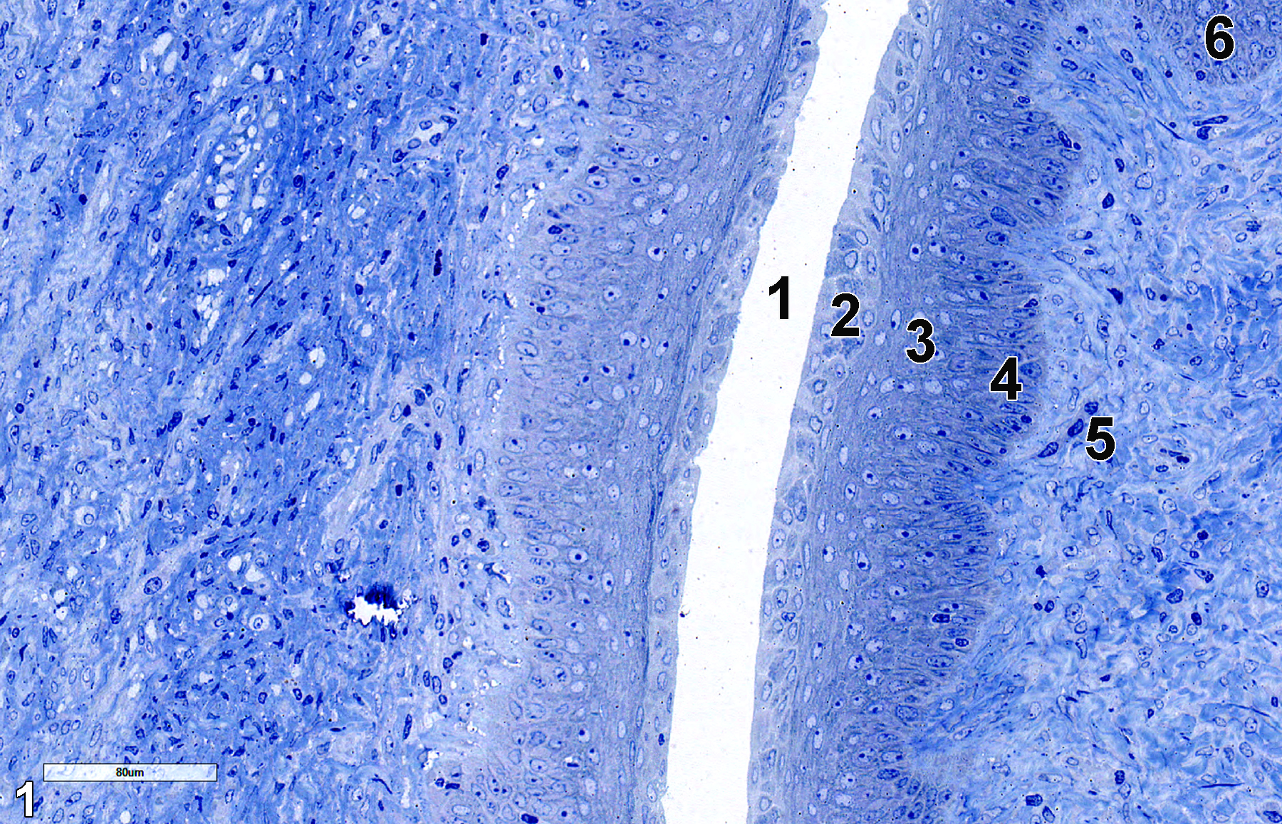 <strong>Figure 1.</strong> A semithin section (0.5 micrometer thick) of a toluidine blue O-stained section of the exocervix showing the cervical lumen (1), the mucus cell layer (2), the stratified non-keratinized epithelial cells (3), the basal cells of the stratified epithelial cell layer (4), the lamina propria (5), which consists of a collagenous matrix with smooth muscle cells and fibroblasts, and a single tubular gland (6). 25x.