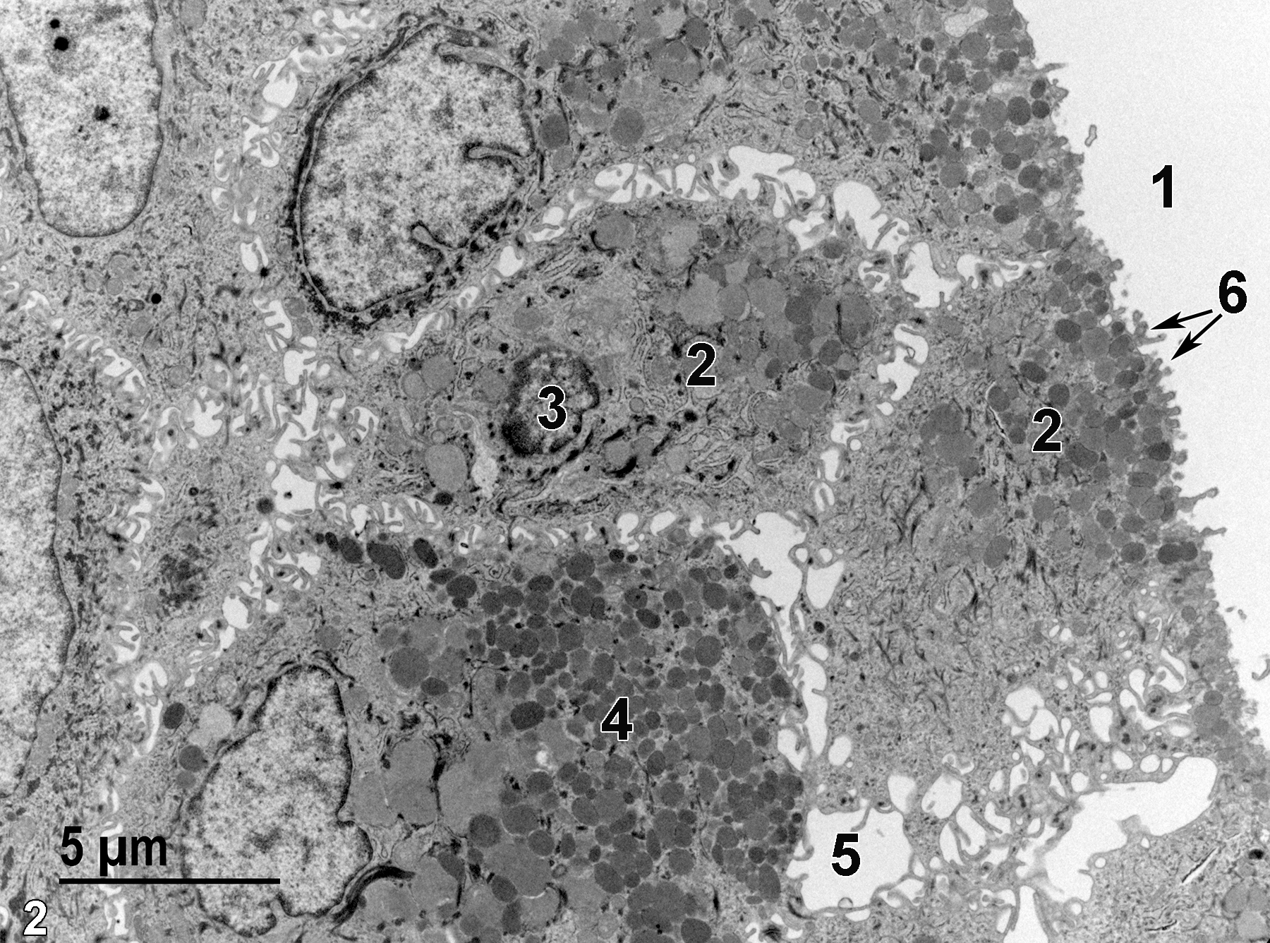 <strong>Figure 2.</strong> An electron micrograph of an area similar to Figure 1 showing the cervical lumen (1), a mucus cell (2) with a single nucleus (3), many mucigen granules (4) of varying size and electron density, intercellular space (5), and microvilli of the mucus cells protruding into the cervical lumen (6, arrows). 4800x.