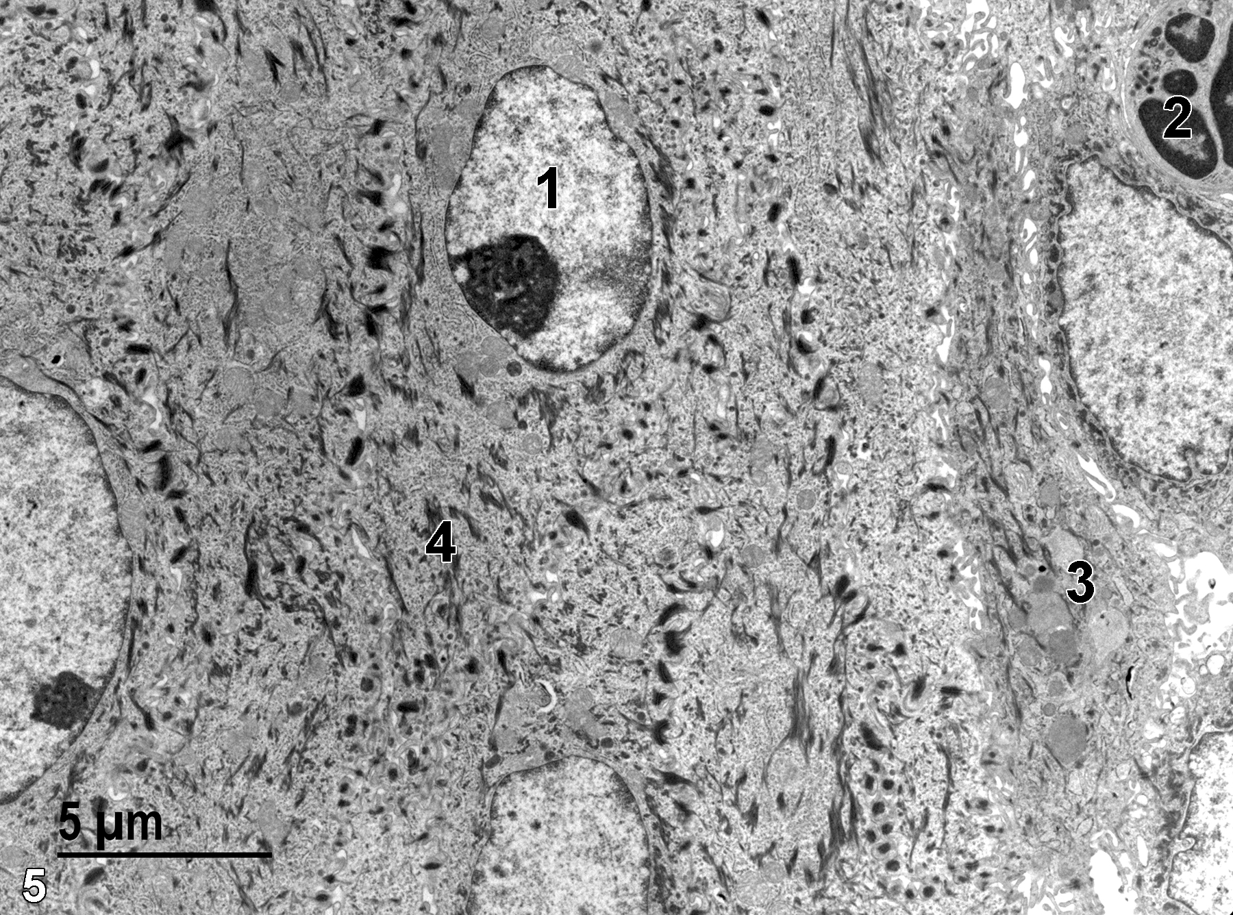 <strong>Figure 5.</strong> A higher magnification view of the stratified squamous epithelial cells. A single nucleus (1) with a prominent nucleolus is present. The upper right corner of the image contains part of a neutrophil (2). Mucigen granules (3) can be seen in a single mucus cell adjacent to the squamous epithelium. Numerous bundles of tonofilaments (4) are visible. 4800x.