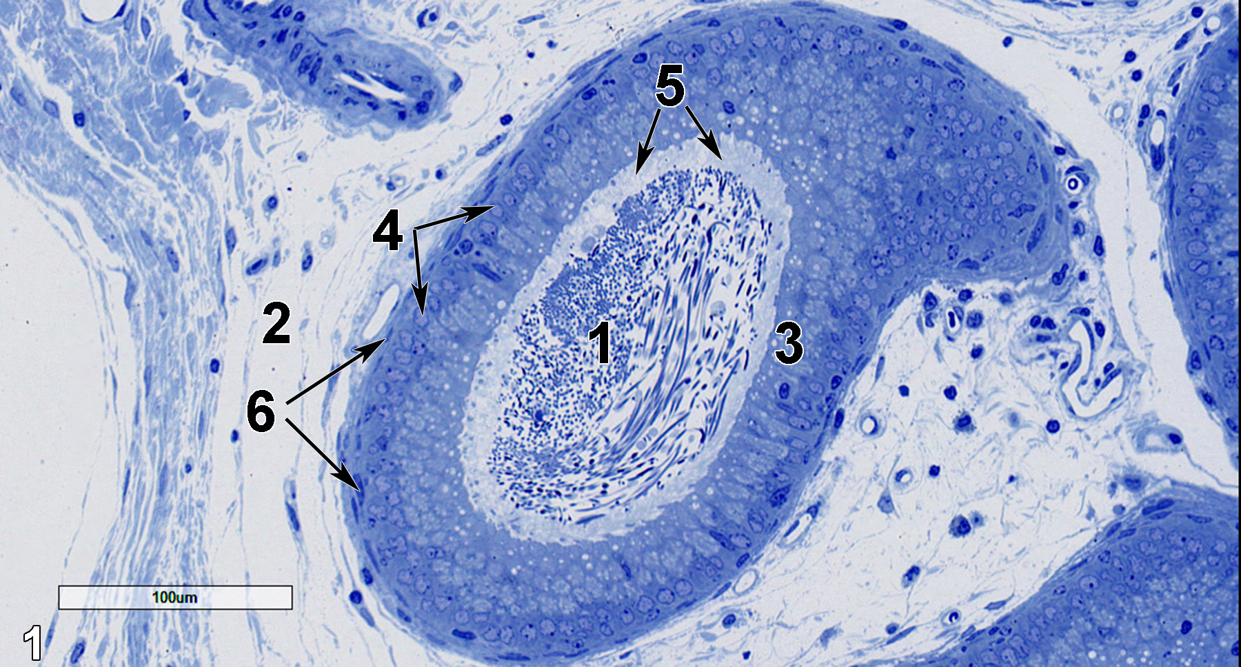 <strong>Figure 1.</strong> A semithin section (0.5 micrometer thick) of a toluidine blue O-stained portion of the ductus epididymis. Numerous spermatozoa (1) are seen in the duct lumen. The duct is surrounded by a matrix of loose connective tissue (2). A row of columnar epithelial cells (3) has lightly stained round nuclei at their basal aspect (4, arrows). The smaller and more darkly stained nuclei of the basal epithelial cells are difficult to discern in this image. Stereocilia (5, arrows) form a lightly stained layer above the columnar epithelial cells, extending into the duct lumen. The smooth muscle cells surrounding the duct have elongated and flattened nuclei (6, arrows) surrounding the duct have elongated and flattened nuclei. 20x.
