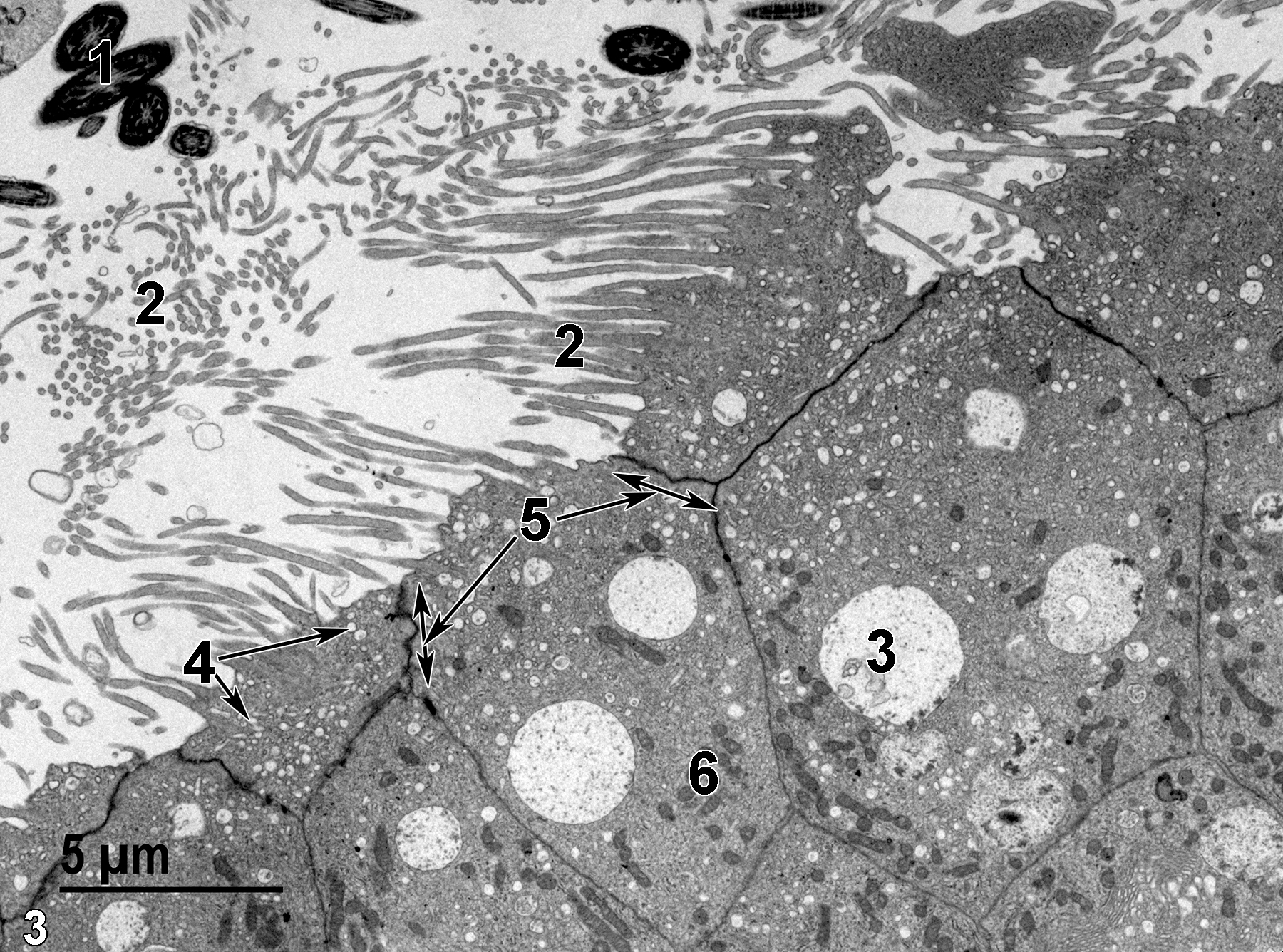 <strong>Figure 3.</strong> A higher magnification view of the apex of columnar epithelial cells. The lumen of the duct contains several midpieces of spermatozoa (1) and stereocilia (2). The epithelial cells have large vacuoles with small amounts of membranous debris (3), numerous pinocytotic vesicles (4, arrows), and prominent junctional complexes binding the adjacent cell surfaces together (5, arrows and double-headed arrows). Mitochondria (6) are fairly numerous. 4800x.