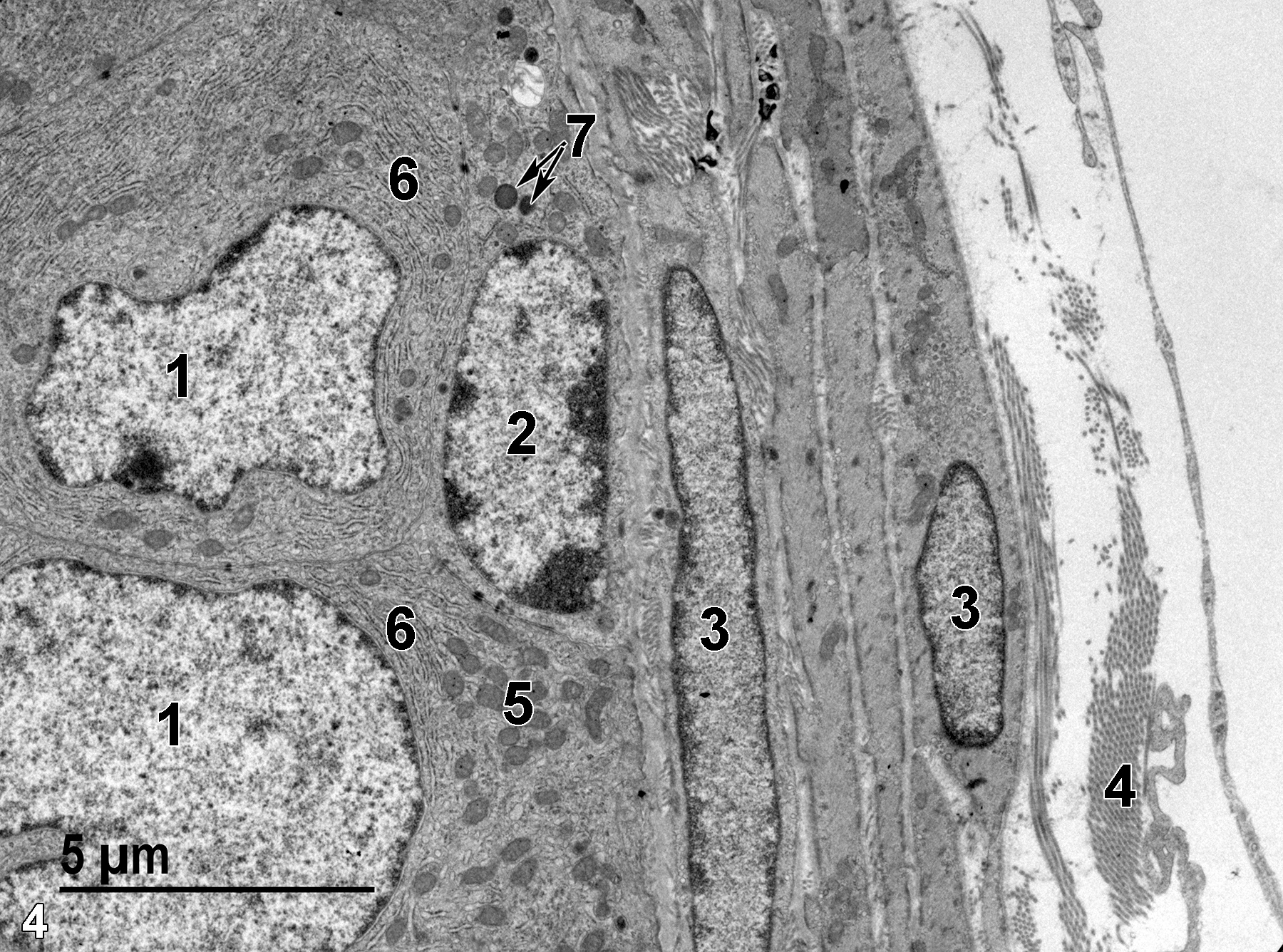 <strong>Figure 4.</strong> The basal aspect of the epithelium with two nuclei of columnar epithelial cells (1) and one nucleus of a basal epithelial cell (2). Note the flattened aspect of the basal cell nucleus and the evident marginated heterochromatin. The underlying smooth muscle cell nuclei (3) are flattened and elongated. Collagen fibers (4) are present between the smooth muscle cells and outside the duct, forming the loose connective tissue between duct segments. The columnar epithelial cells contain more mitochondria (5) than those found in the basal epithelial cells. Large amounts of rough endoplasmic reticulum (6) are found in the basal aspect of the columnar epithelial cells. Lysosomes are evident in the basal epithelial cell (7, arrows). 6800x.