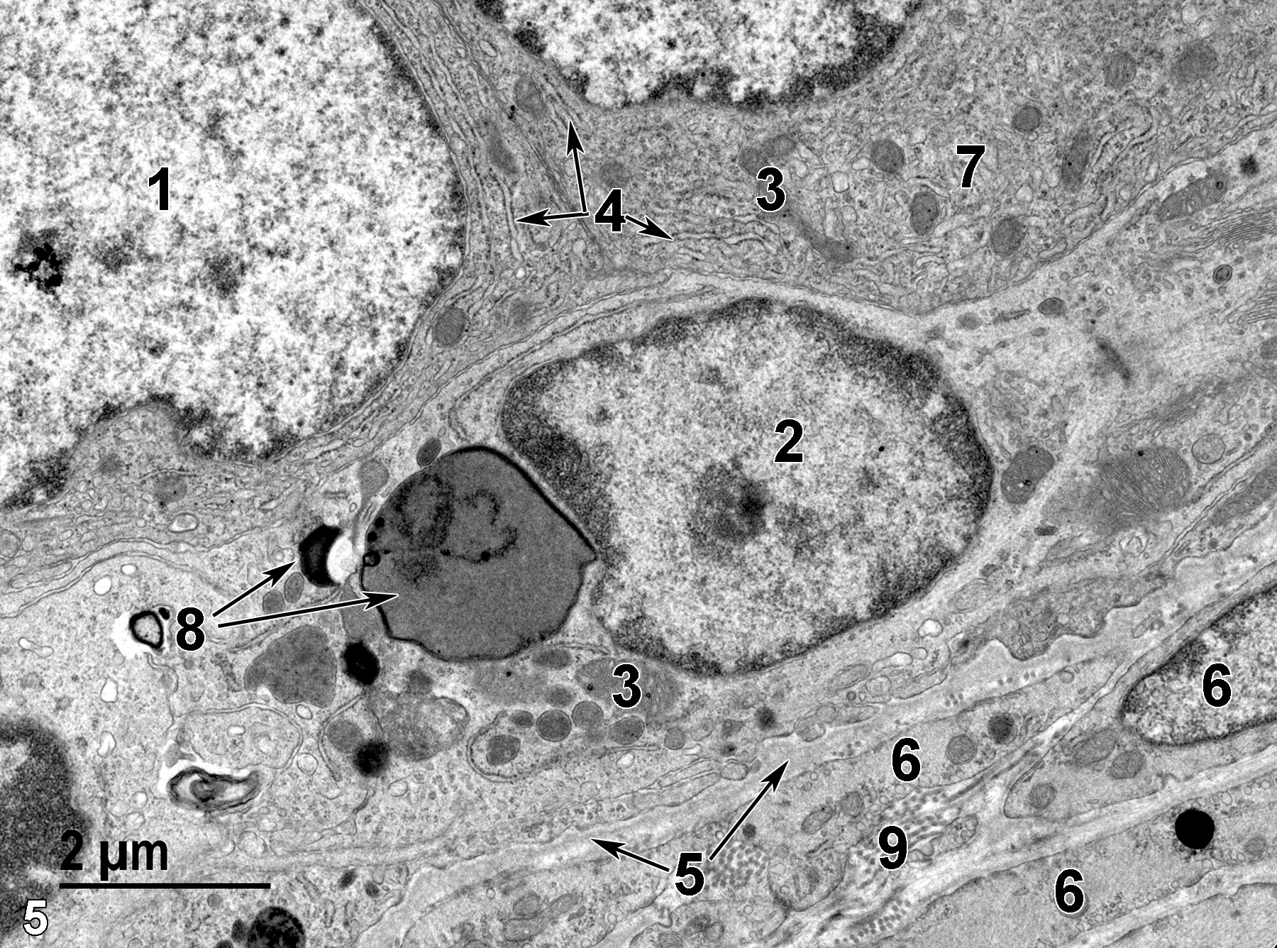 <strong>Figure 5.</strong> A higher magnification view of the base of the duct. Two columnar cells are shown, one with a large nucleus (1) with dispersed heterochromatin. A single basal epithelial cell has a smaller nucleus with marginated chromatin (2), mitochondria (3), and several lysosomes showing variable size and electron density (8, arrows). The columnar cells contain prominent rough endoplasmic reticulum (4, arrows), mitochondria (3), and some areas of smooth endoplasmic reticulum (7). The basal epithelial cell layer is separated from the smooth muscle cells (6) by a thin basal lamina (5, arrows). Collagen fibers (9) are found between the smooth muscle cells. 11000x.