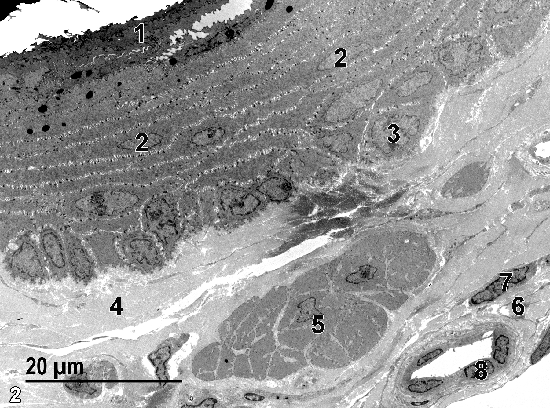 <strong>Figure 2.</strong> A low magnification electron micrograph of the esophagus, showing the sloughing keratinized epithelial surface (1), the elongated nuclei of squamous epithelial cells (2), a rounded nucleus (3) of a basal epithelial cell, and collagen bundles of the lamina propria (4). Below the lamina propria is the muscularis mucosae, which contains a layer of smooth muscle cells (5) with adjacent collagen fibrils. The submucosal layer (6) beneath that is composed of more connective tissue that contains fibroblasts and small blood vessels. An elongated fibroblast nucleus (7) and an endothelial nucleus of a small vessel (8) are shown. 1900x.