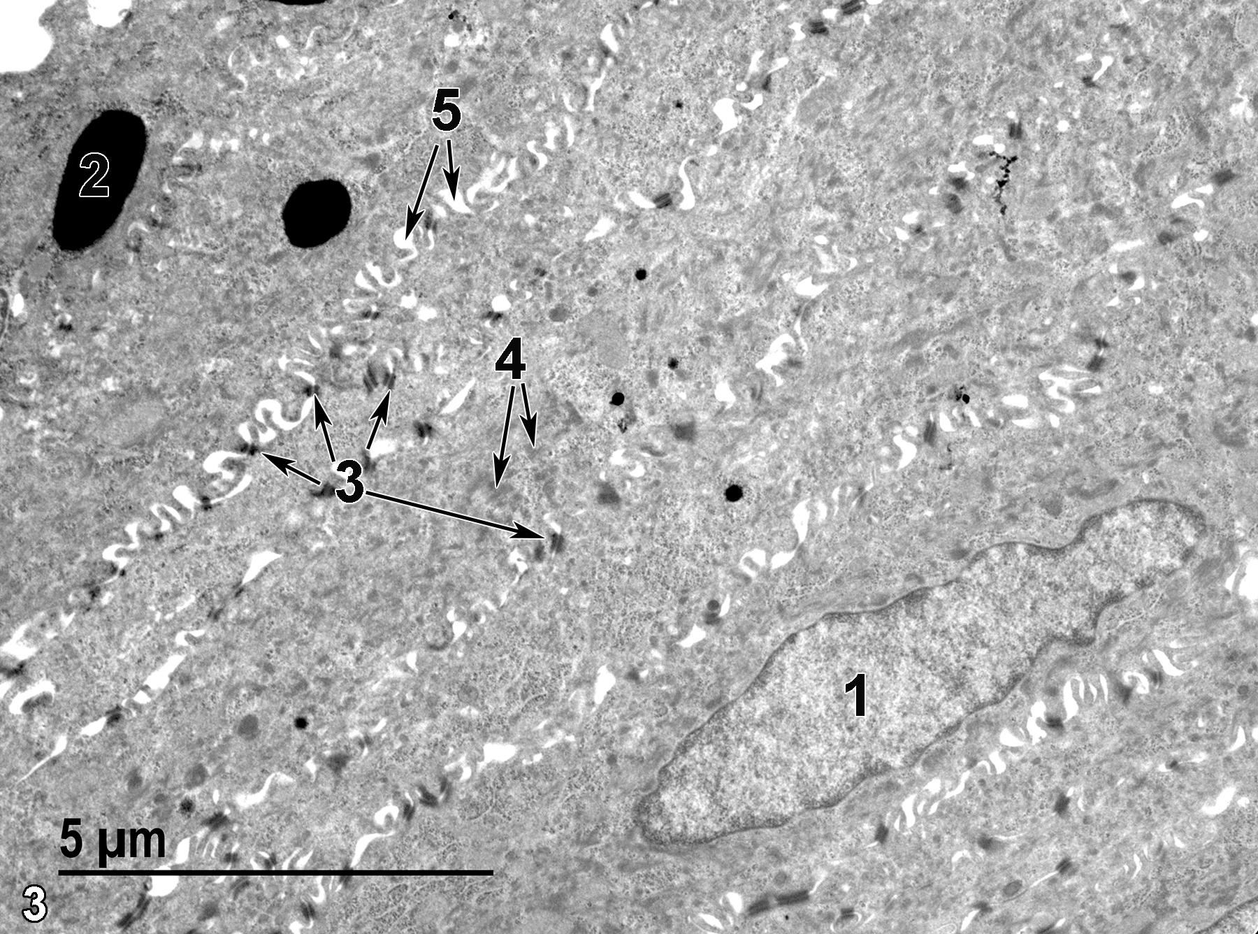 <strong>Figure 3.</strong> A portion of the stratified squamous epithelium. An elongated nucleus of an epithelial cell (1) is shown. An electron-dense melanosome (2) is present in an epithelial cell. Desmosomes (3) are numerous, primarily binding apical portions of adjacent epithelial cells (arrows). Bundles of tonofilaments (4) are seen in the cytoplasm, often associated with desmosomes (double arrows). Numerous intercellular spaces (5) are visible between the cellular projections (double arrows). 9300x.