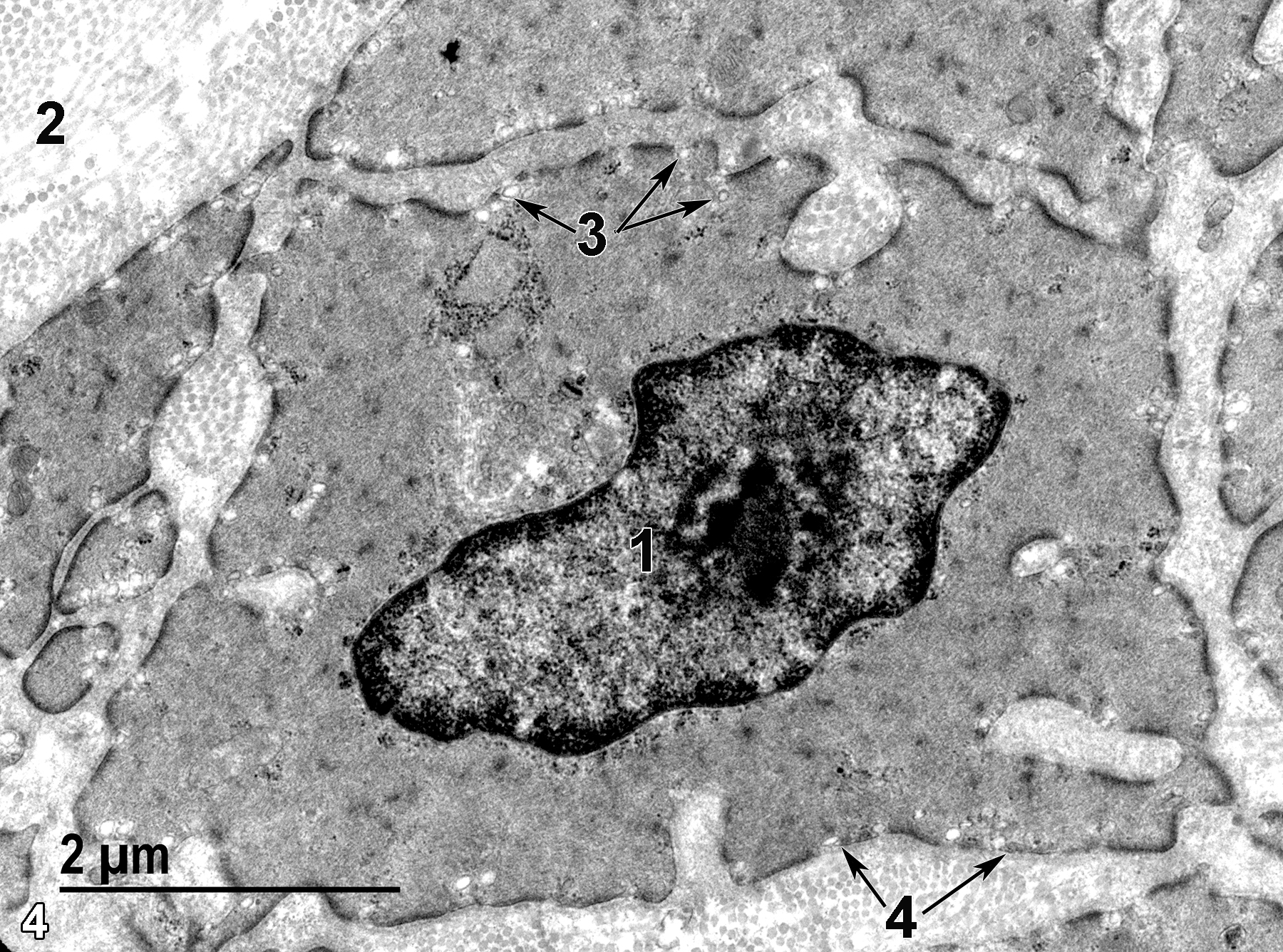 <strong>Figure 4.</strong> Some details of smooth muscle cells from the muscularis mucosae layer. The smooth muscle cells contain a single nucleus (1) and are surrounded by collagenous fibrils (2).Micropinocytotic vesicles (3) are visible at the surface of the cell (arrows). Each cell is surrounded by a basal lamina (4, double arrows). 18500x.
