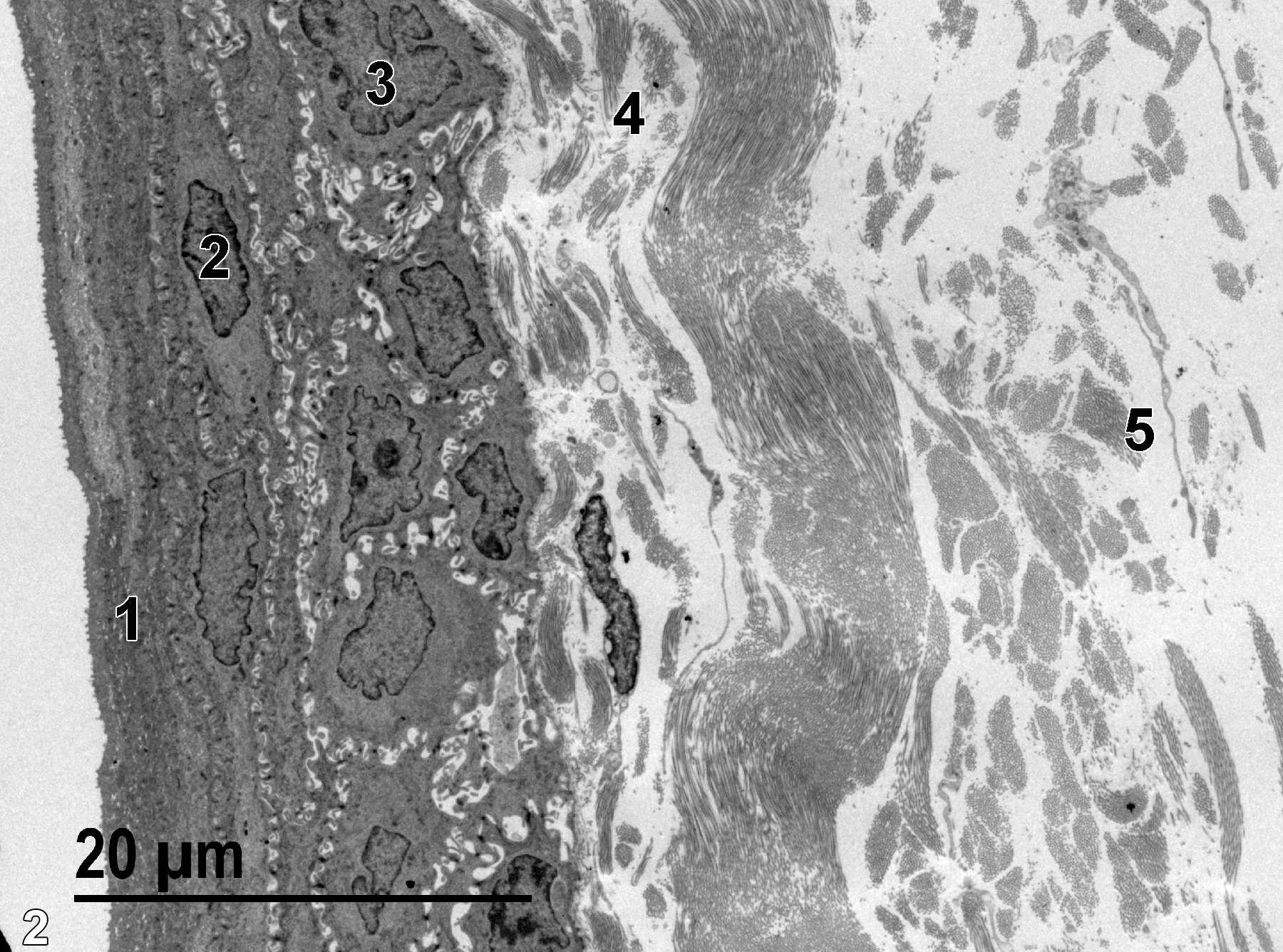 <strong>Figure 2.</strong> An ultrathin section (80-90 nm thick) of the cornea. The outermost layer of the cornea is composed of flattened squamous epithelial cells (1) with short vermiform ridges that resemble short microvilli in section (Weiss 1988, p. 1076). The nuclei (2) in this layer are elongated with peripheral heterochromatin. Below the squamous epithelial layer are several layers of polygonal cells and columnar cells (3). The first narrow layer of the corneal stroma (4) consists of randomly distributed collagenous fibrils. This layer is known as Bowman’s membrane in human eyes (Dunn et al 2018). The much wider corneal stroma layer (5) is composed of bundles of collagenous fibrils of uniform diameter, running in different directions, with matrical materials between them, as well as sparse populations of fibroblasts. 1900x.