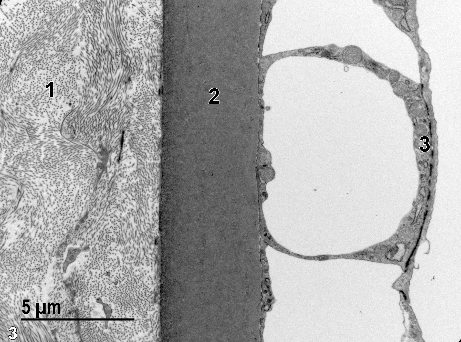<strong>Figure 3.</strong> A higher magnification view of the basal area of the corneal stroma (1) with bundles of collagen fibrils and small cytoplasmic extensions of fibroblasts. Deep to the stromal layer is the homogeneous elastic membrane (2) composing Descemet’s membrane. This layer, in turn, underlays the corneal endothelium (3), which is highly vacuolated in the area imaged. 6800x.