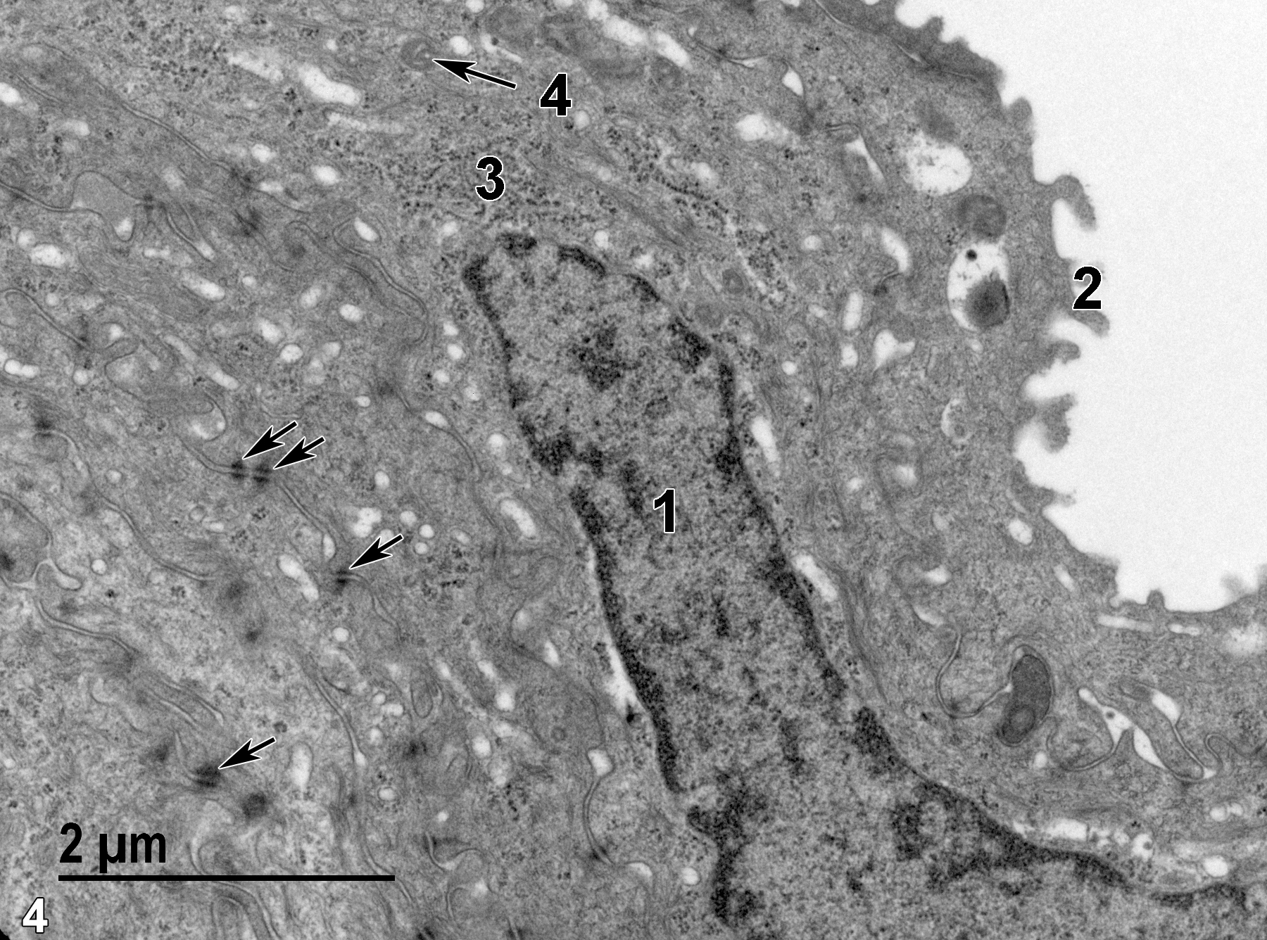 <strong>Figure 4.</strong> A high magnification view of squamous epithelial cells of the cornea, showing a portion of a typical elongate squamous epithelial cell nucleus (1) with marginated heterochromatin, transverse sections of the vermiform ridges (2) of the superficial epithelial cells, desmosomes between adjacent cells (arrows), polysomes and rough endoplasmic reticulum (3), and relatively scarce small mitochondria (4, arrow). 18500x.