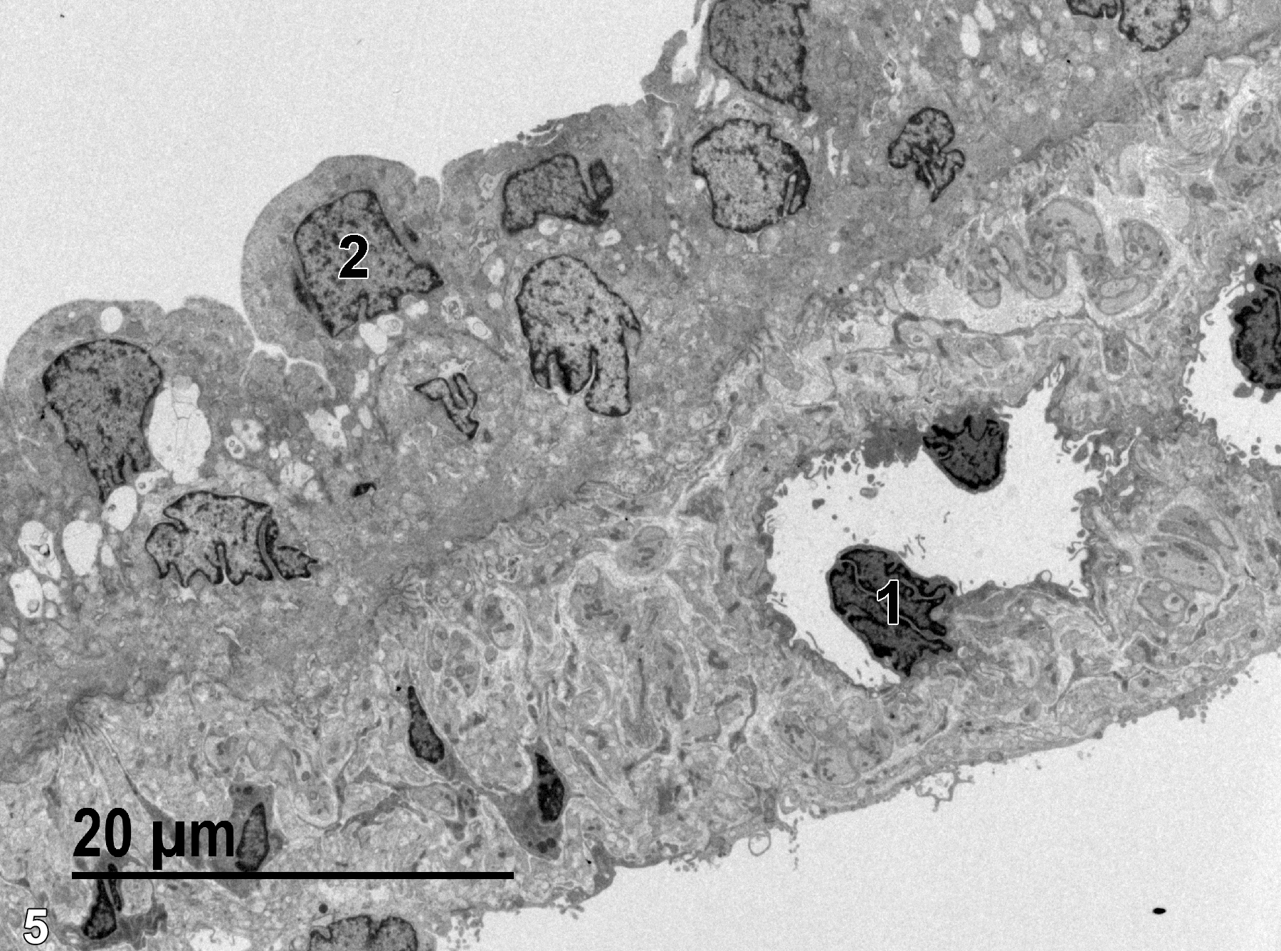<strong>Figure 5.</strong> A low magnification view of a portion of the iris. An endothelial nucleus (1) of a capillary in the anterior surface of the iris is shown, surrounded by neural elements and connective tissue. The posterior surface of the iris is characterized by cuboidal epithelial cells containing a single nucleus (2). 1900x.