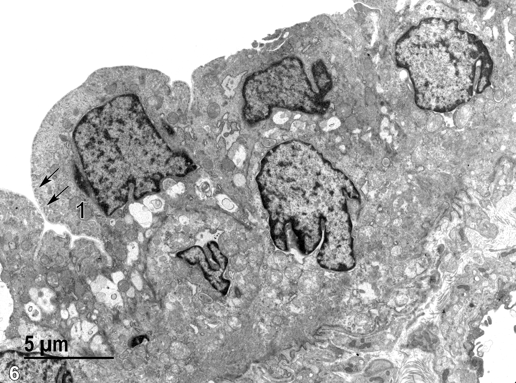 <strong>Figure 6.</strong> A higher magnification view of the epithelial cells of the posterior iris surface with infoldings of the cell surface (arrows) overlaid by a thin basal lamina. Mitochondria (1) are mostly round with relatively dense matrical content. Vacuolated areas are seen near the basal aspect of the cells. 4800x.