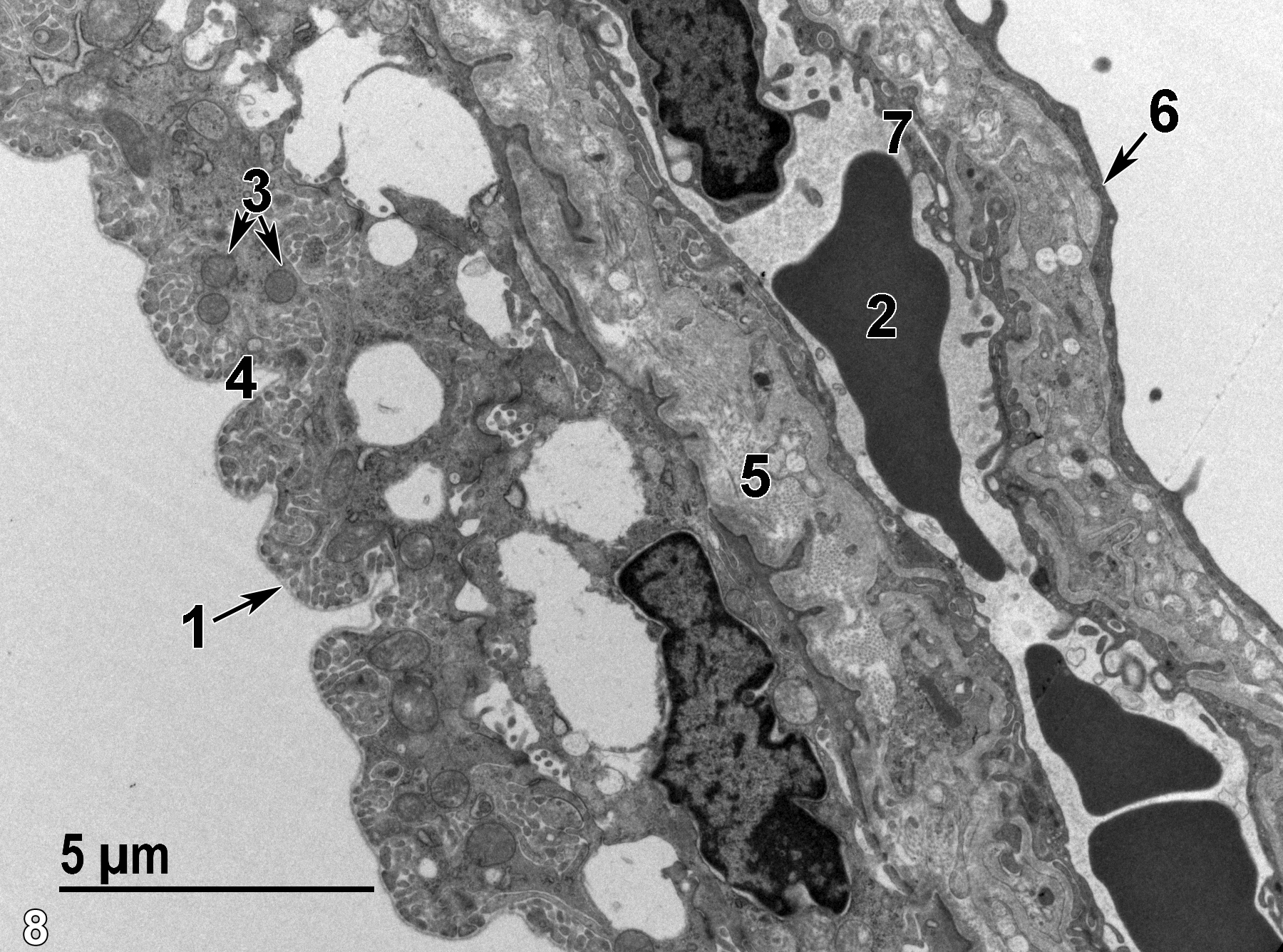 <strong>Figure 8.</strong> A low magnification view of the ciliary process, with cuboidal epithelial cells facing the posterior chamber with markedly infolded surfaces (4) beneath a basal lamina (1). Numerous mitochondria (3, double arrows) show mostly rounded profiles. There are two layers of epithelial cells, and the elongated nucleus (6, arrow) represents the pigmented layer of epithelial cells in the rat, although the albino rat shown here has few cells with melanin granules (none shown here). The ciliary stroma (5) contains large amounts of collagen produced by fibroblasts. A large capillary containing erythrocytes (2) is lined with a thin endothelial layer (7). 6800x.