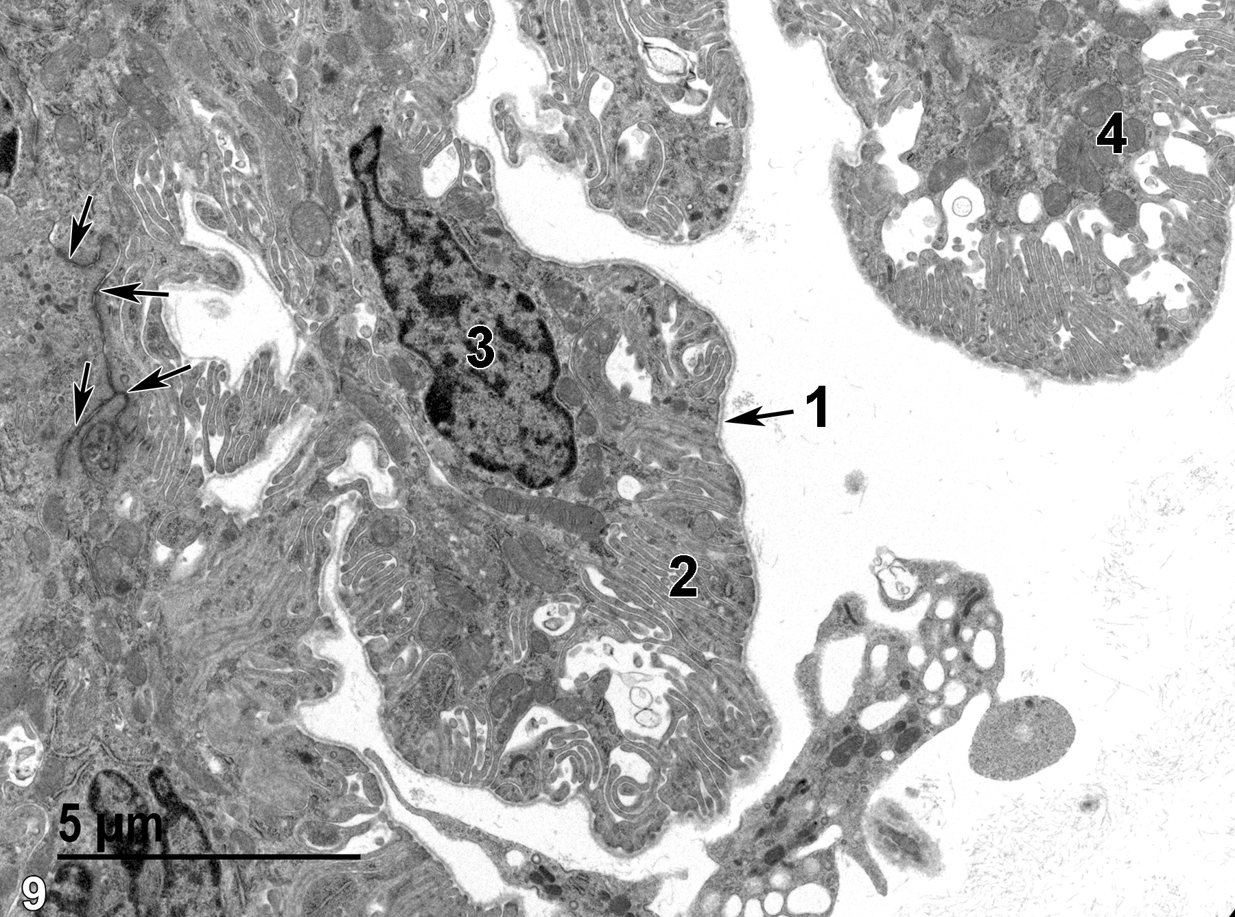 <strong>Figure 9.</strong> Another view of the ciliary process clearly showing the basal lamina (1) overlying the markedly infolded cell surface (2) of an epithelial cell with a single nucleus (3). Mitochondria (4) are plentiful and elongated junctional complexes (arrows) can be seen between adjacent epithelial cells. 6800x.
