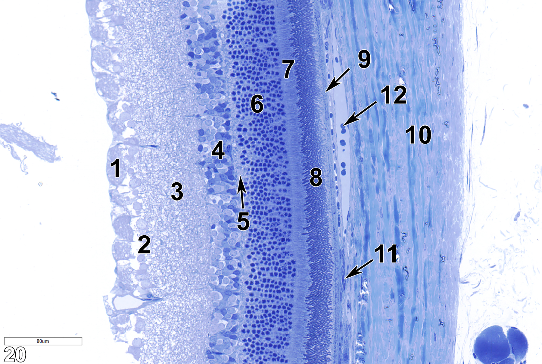 <strong>Figure 20.</strong> A toluidine blue O-stained semithin section of the retina. The nerve fiber layer (1) is next to the ganglion cell layer (2), which consists of cells with large round nuclei. The next layer is the inner plexiform (synaptic) layer (3), followed by the inner nuclear layer (4). This, in turn, is followed by the outer plexiform layer (5, arrow) and the outer nuclear layer (6). The outer layer of the photoreceptor cells (7) follows and then the inner layer of the photoreceptor cells (8). Next is the pigmented epithelium (9, arrow), followed by Bruch’s membrane (11, arrow). The choroid (10) is a broad collagenous matrix, within which are various blood vessels containing erythrocytes (12, arrow). 25x.