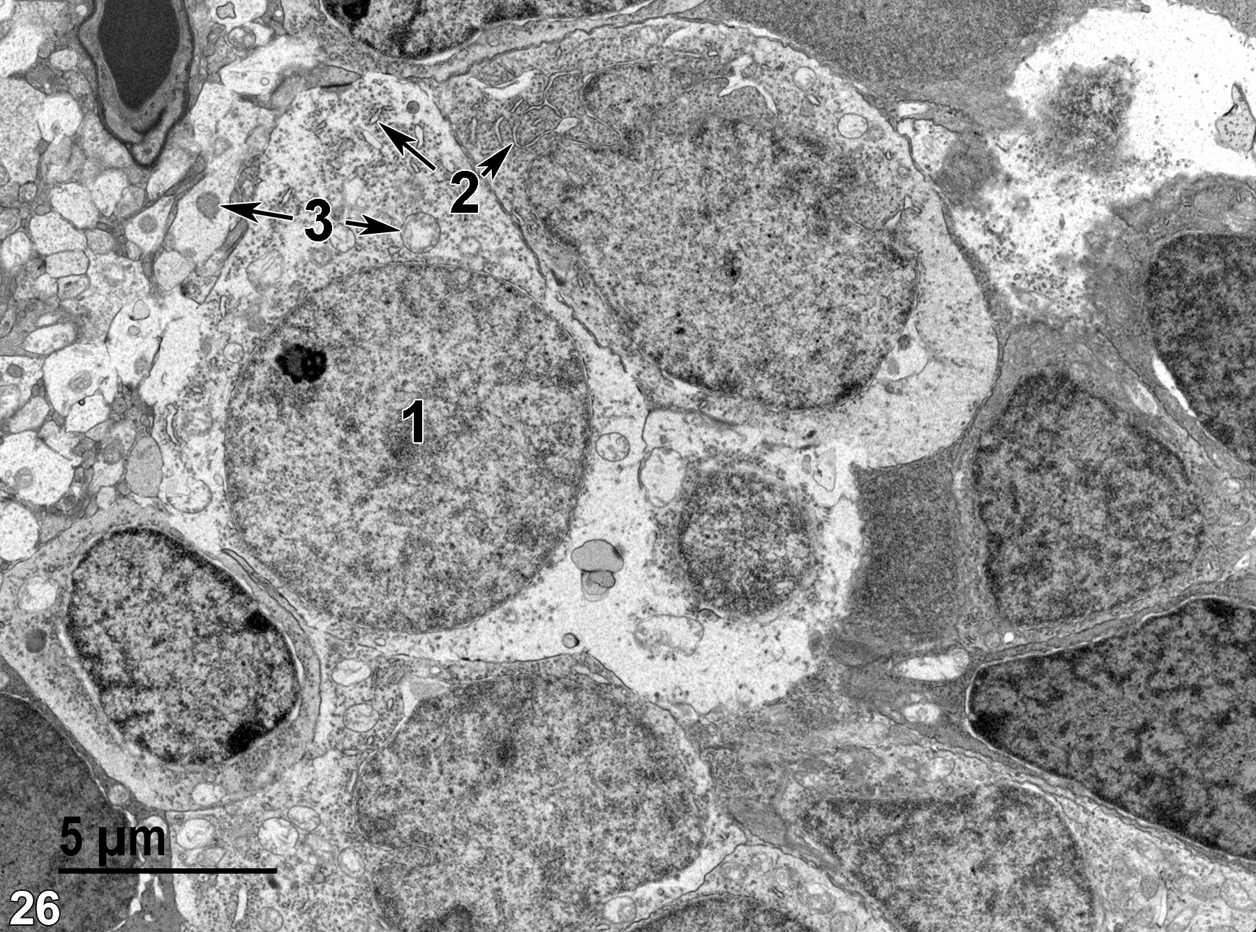 <strong>Figure 26.</strong> Rounded nuclei (1) of cells in the inner nuclear layer. Elements of rough endoplasmic reticulum (2, double arrows) are also visible within the cells. Note the difference in morphology of the mitochondria of the inner nuclear layer cell and those of the plexiform layer neural processes (3, double arrows). 4800x.
