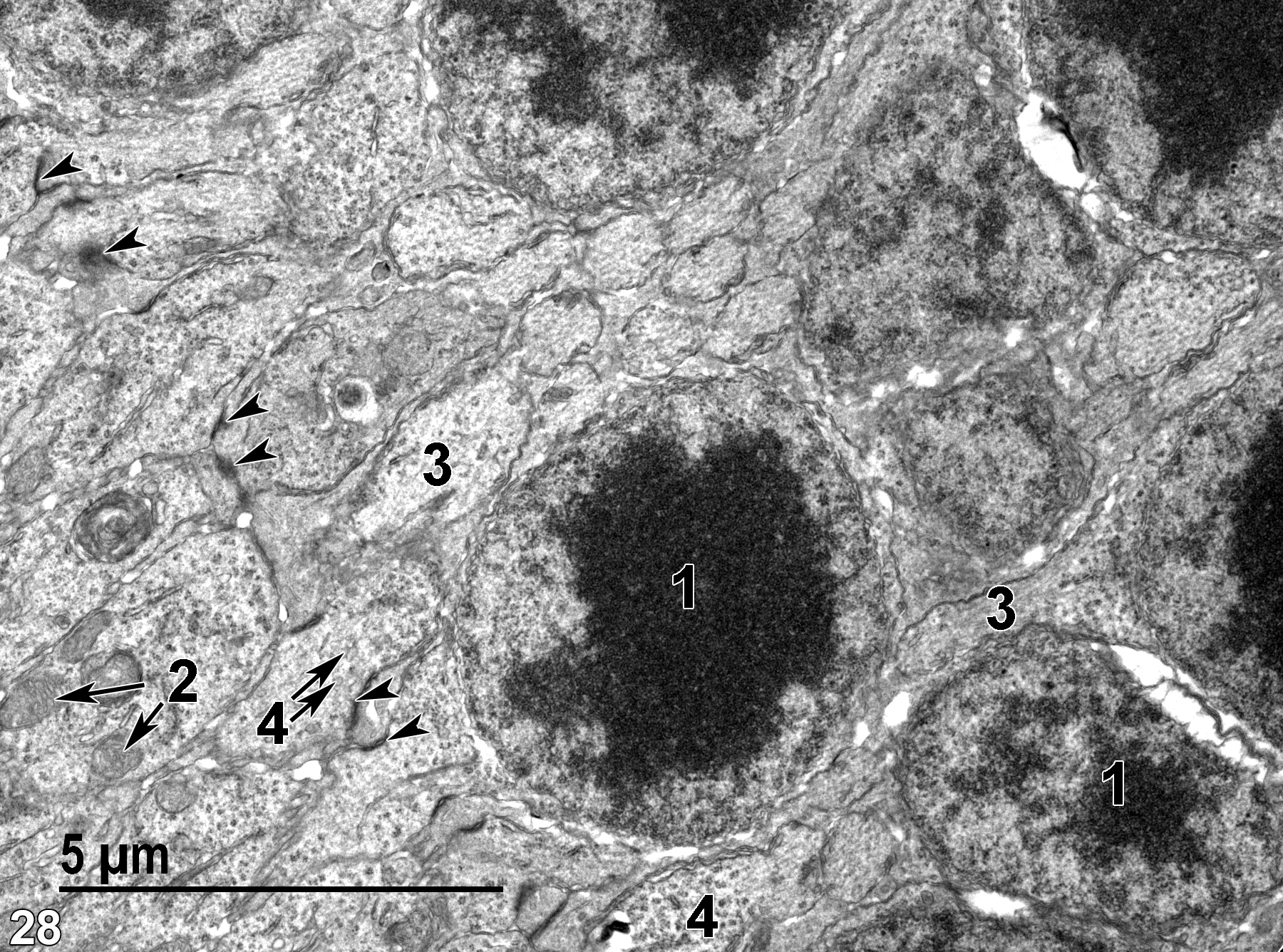 <strong>Figure 28.</strong> Nuclei (1) of the outer nuclear layer (the perikarya of the rods and cones) and the zonulae adherens (arrowheads) making up the outer limiting membrane of the retina. Mitochondria (2) are scarce (double arrows). Some of the neural processes contain obvious microfilaments (3). Nerve endings containing synaptic vesicles (4) are shown (double arrows). 9300x.