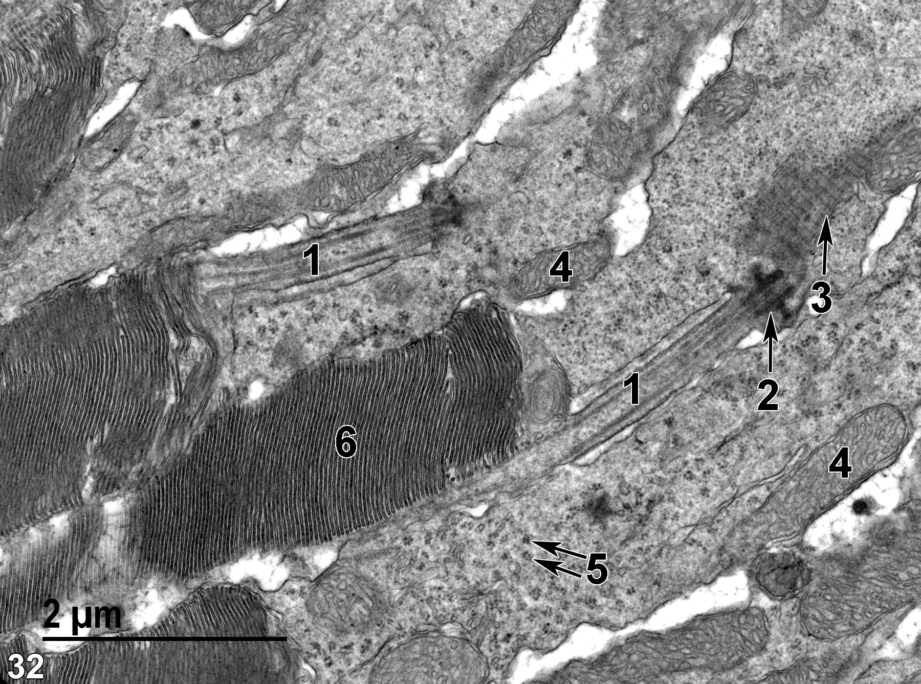 <strong>Figure 32.</strong> A higher magnification image of the membranous discs of the outer segment of rods (6). Within the rod cell cytoplasm, a single modified cilium (1) is present with a well-defined basal body (2, arrow) and a rootlet (3, arrow). The cytoplasm also contains numerous polysomes (5, double arrows) and mitochondria (4). 18500x.