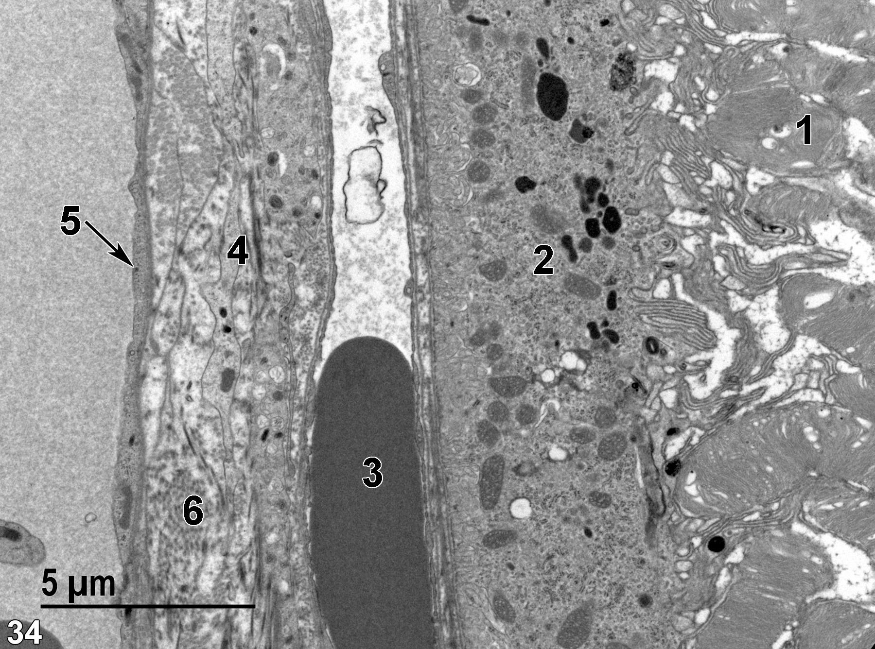 <strong>Figure 34.</strong> A higher magnification view of the membranous discs of the outer segments of rods and cones (1), the pigmented epithelium (2), which contains melanin granules, a blood vessel containing an erythrocyte (3), Bruch’s membrane (4) with numerous cell processes intermixed with collagen fibrils (6), and another vessel with a thin endothelial lining (5, arrow). 6800x.