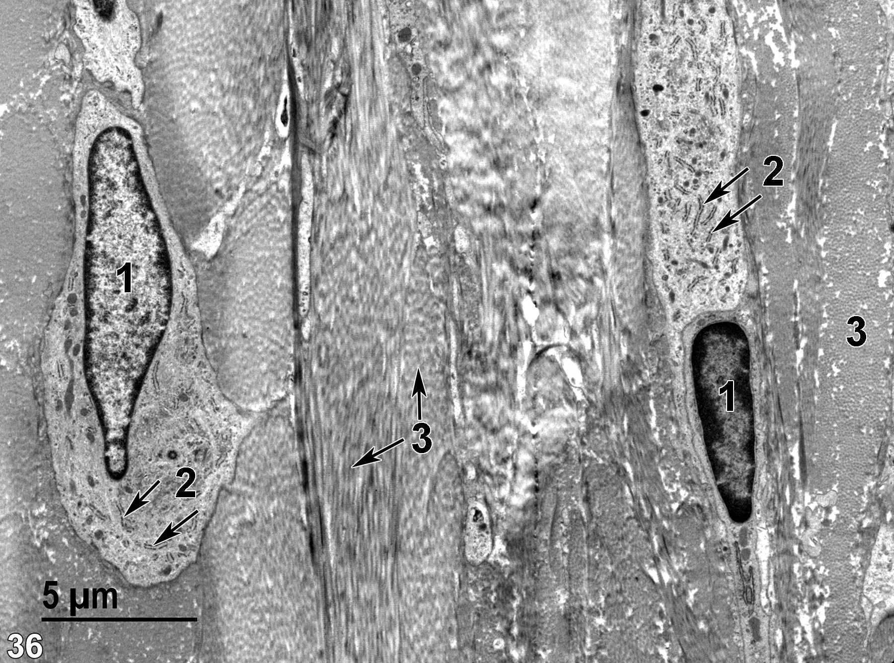 <strong>Figure 36.</strong> The structure of the elements within the choroid. Bundles of collagen fibrils (3) can be seen in the transverse and longitudinal section (double arrows), associated with the fibroblasts (1) that produce the collagen. The fibroblasts have elongated nuclei with prominent marginal heterochromatin and numerous profiles of rough endoplasmic reticulum (2, arrows). 4800x.