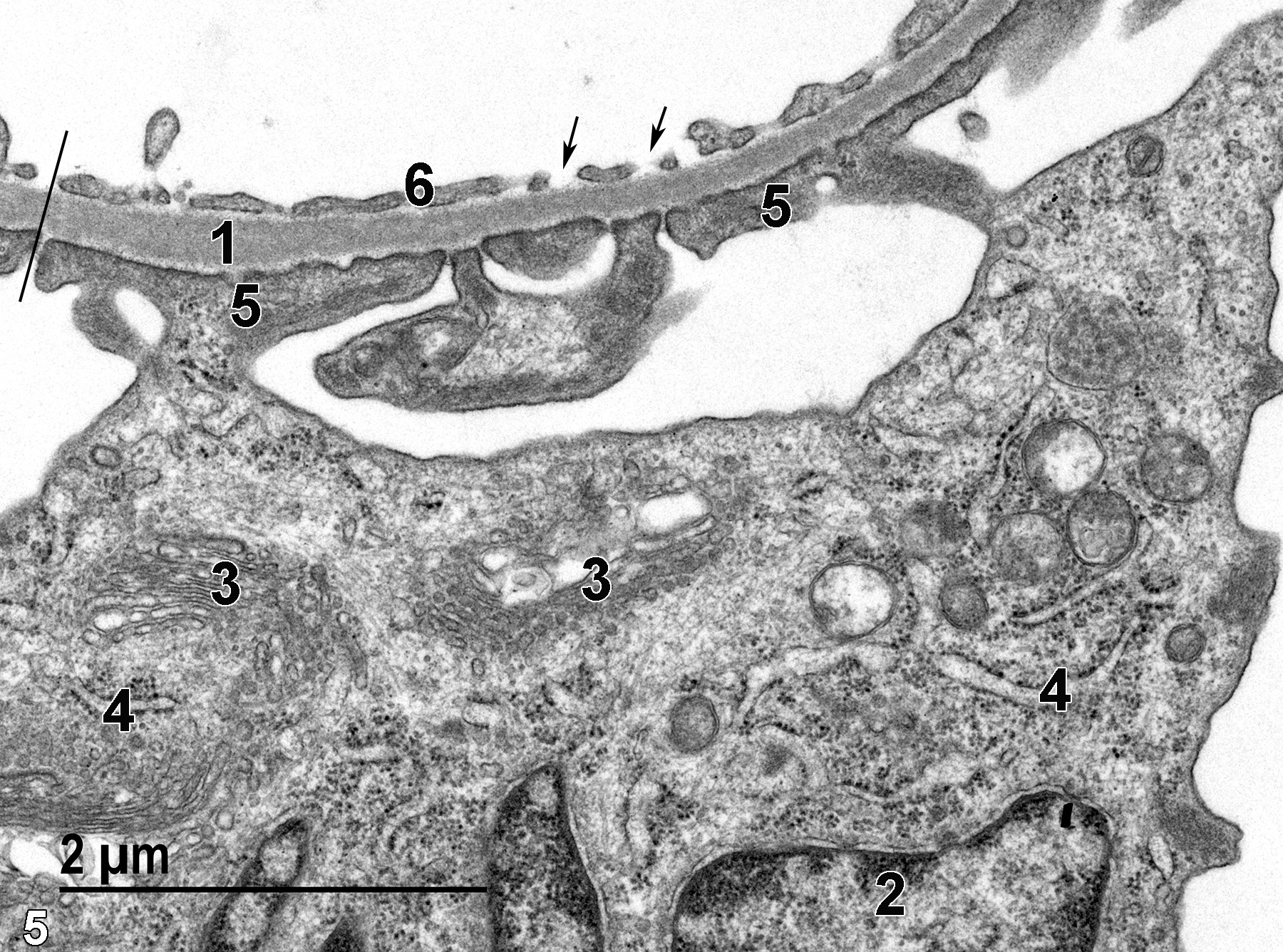 <strong>Figure 5.</strong> A higher magnification of a portion of a glomerulus showing a podocyte nucleus (2), Golgi bodies within the podocyte (3), rough endoplasmic reticulum (4), and foot processes (5) of the podocyte (pedicles) adjacent to the basal lamina (1), overlaid by the fenestrated endothelium of a capillary (6, arrows). The black line crossing the capillary endothelium, basal lamina, and the pedicles defines the filtration membrane of the glomerular system. Magnification not provided.