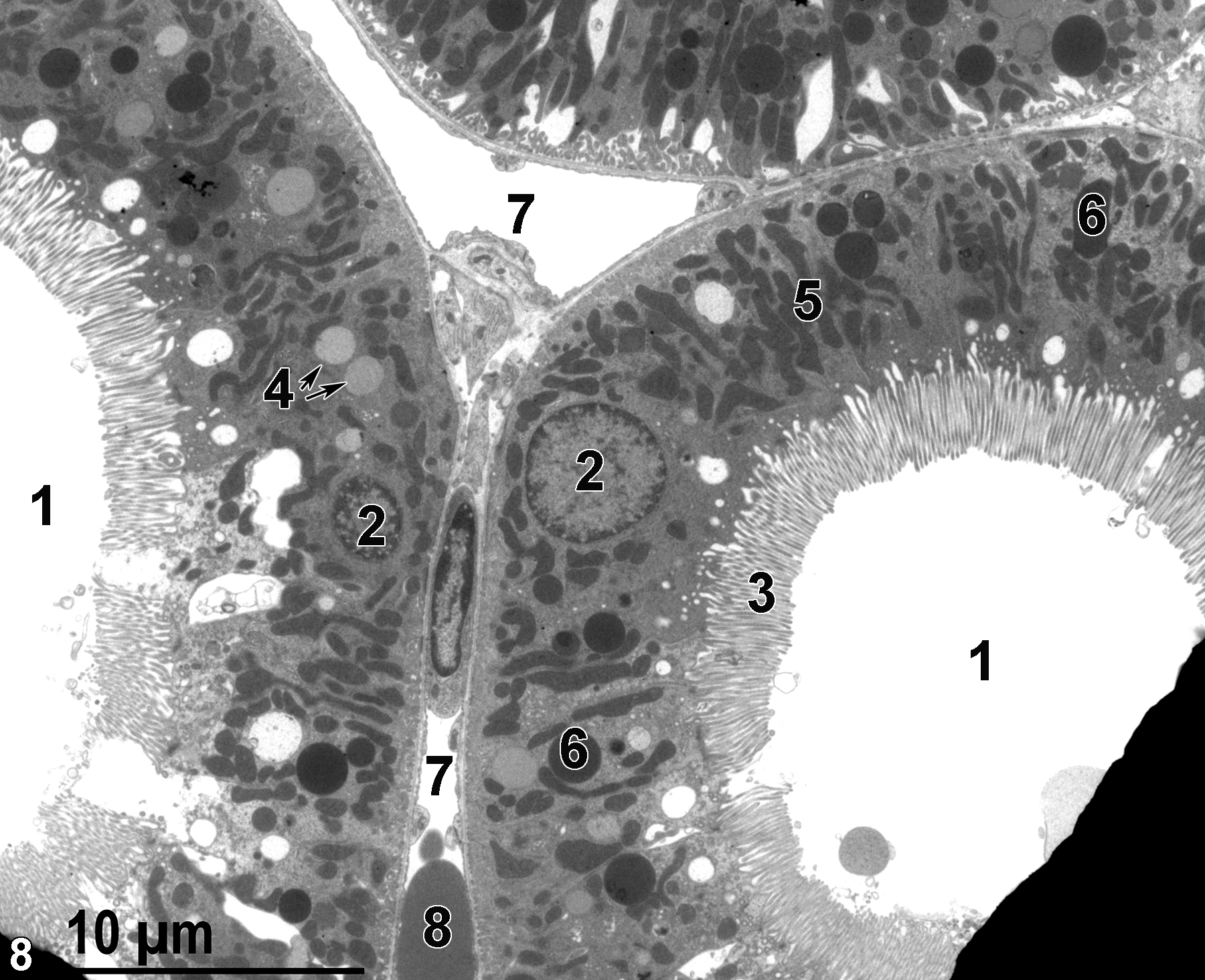 <strong>Figure 8.</strong> A low magnification image from a kidney perfusion that prevented the proximal convoluted tubules from collapsing, as happens with whole-body perfusions or immersion-fixation of kidneys. Electron-opaque grid bars are visible at the lower left and right of the image. The patent lumens of two proximal convoluted tubules (1) are lined with long microvilli (3). The epithelial cells of the tubules contain nuclei (2), mitochondria (5), lysosomes (6), and lipid bodies (4, arrows). Two peritubular capillary lumens (7) are shown, one containing an erythrocyte (8). Magnification not provided.