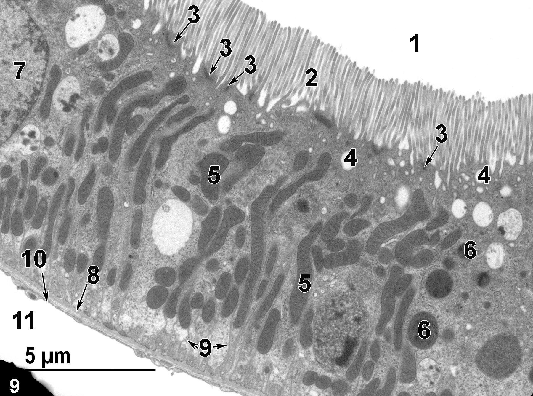 <strong>Figure 9.</strong> A higher magnification view of a proximal convoluted tubule from a perfused kidney showing the tubule lumen (1), microvilli (2), junctional complexes (3, arrows), apical vacuoles (phagosomes) (4), elongated mitochondria (5), lysosomes (6), a tubule epithelial cell nucleus (7), and basal infoldings of the epithelial cell membrane (9, arrows). The epithelial cells are underlaid by a basal lamina (8, arrow) that is, in turn, underlaid by the fenestrated endothelium of a peritubular capillary (10) and the capillary lumen (11). The edge of a grid bar is visible at the lower left of the image. Magnification not provided.