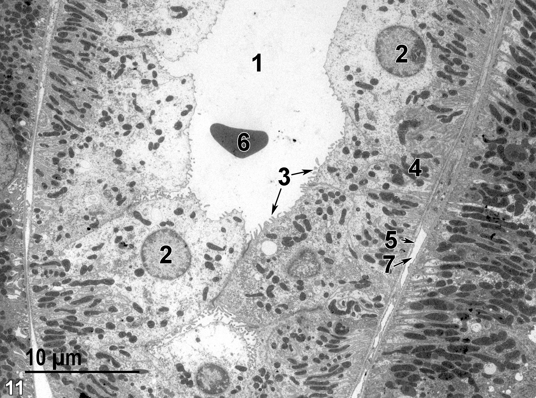 <strong>Figure 11.</strong> A distal convoluted tubule from the kidney cortex. The epithelial cells of the tubule have round nuclei (2) with marginated heterochromatin and short microvilli (3, arrows). The tubule lumen (1) contains one erythrocyte (6). Mitochondria are abundant, particularly in the basal area (4) of the epithelial cells. The peritubular capillary lumen (7, arrow) is lined with a fenestrated endothelium (5, arrow). Magnification not provided.