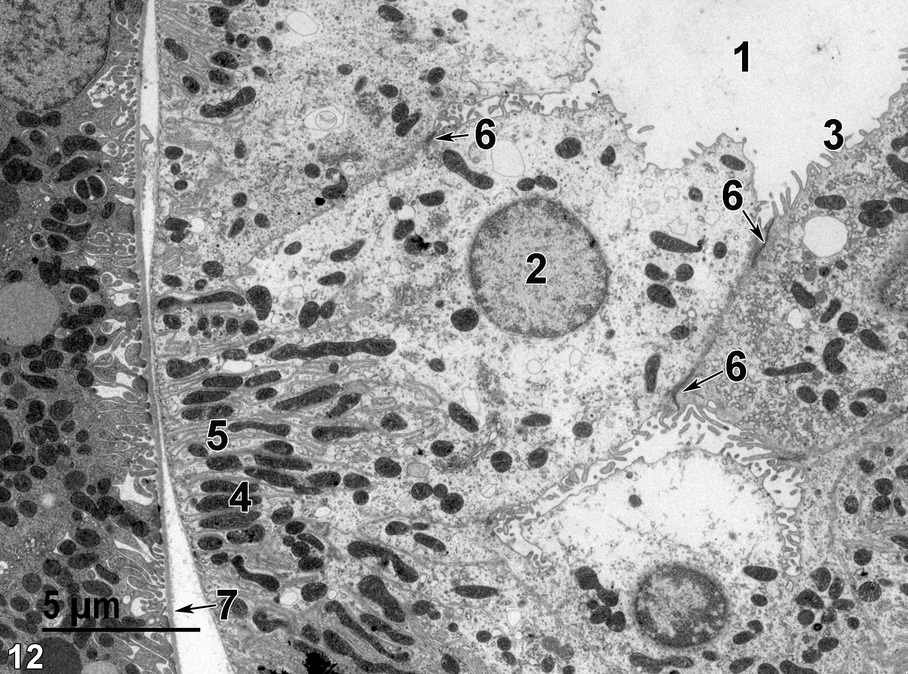 <strong>Figure 12.</strong> A higher magnification of Figure 11 showing the tubule lumen (1), a nucleus (2), short microvilli (3), elongated mitochondria (4) in the basal region of the epithelial cell intermixed with basal infoldings (5) of the plasma membrane. Junctional complexes (6, arrows) are found at the apical border of the epithelial cells. A basal lamina (7, arrow) is shown at the base of the epithelial cells. Magnification not provided.