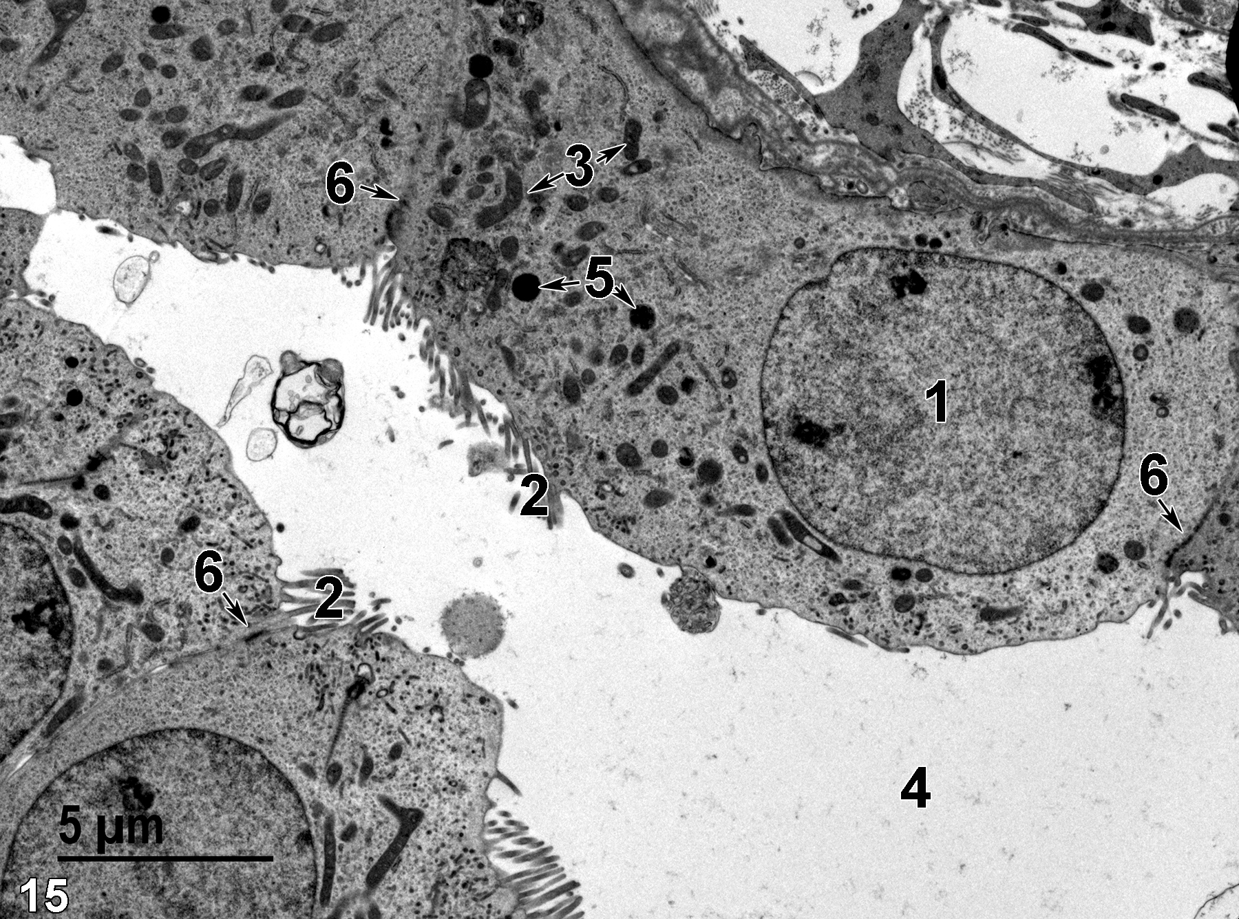 Image of a thick limb showing microvilli clusters, a nucleus, lysosomes, mitochondria, tubule lumen and junctional complexes.