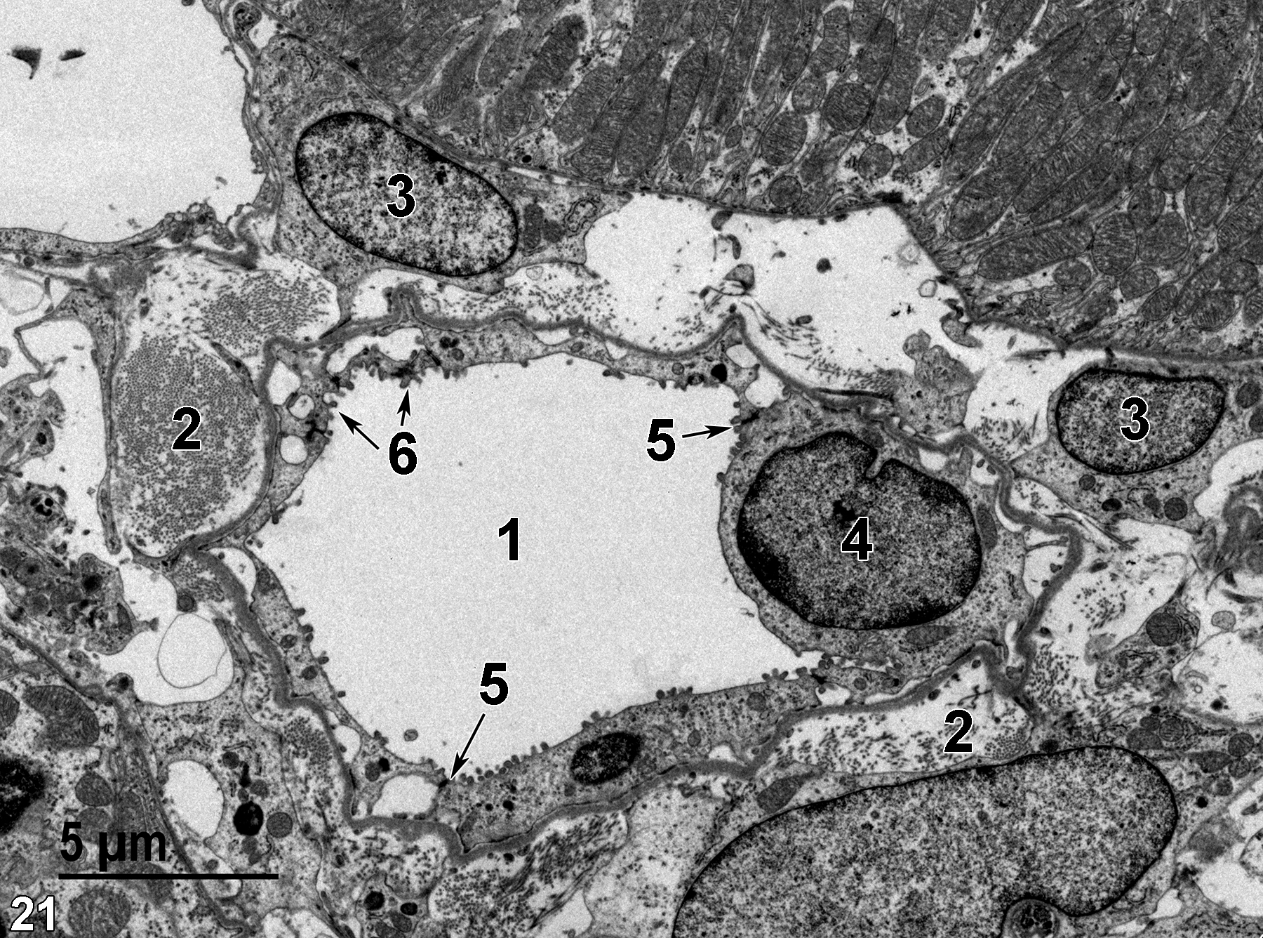 <strong>Figure 21.</strong> An image showing the lumen of a thin limb (1), collagen of connective tissue (2), nuclei of connective tissue cells (3), a nucleus of a thin limb epithelial cell (4), junctional complexes between adjacent tubule epithelial cells (5, arrows), and microvilli of the thin limb epithelial cells (6, arrows). 4800x.