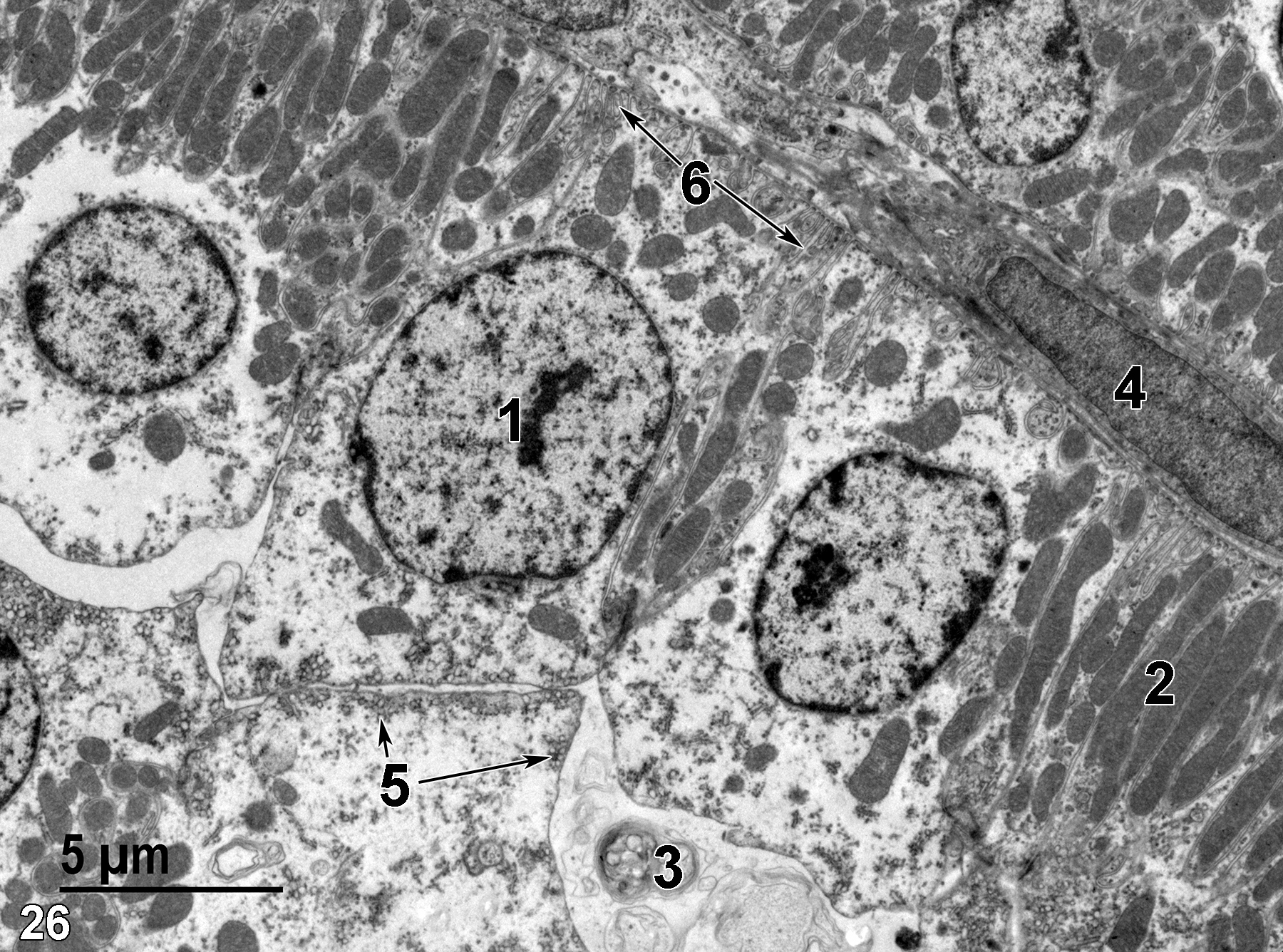 <strong>Figure 26.</strong> A higher magnification view of a collecting duct showing elongated mitochondria (2), the membranous debris (3) within the duct lumen, the nucleus of a connective tissue cell (4), apical vesicles in an epithelial cell (5, arrows), the nucleus (1), and basal infoldings (6, arrows) of an epithelial cell. 4800x.