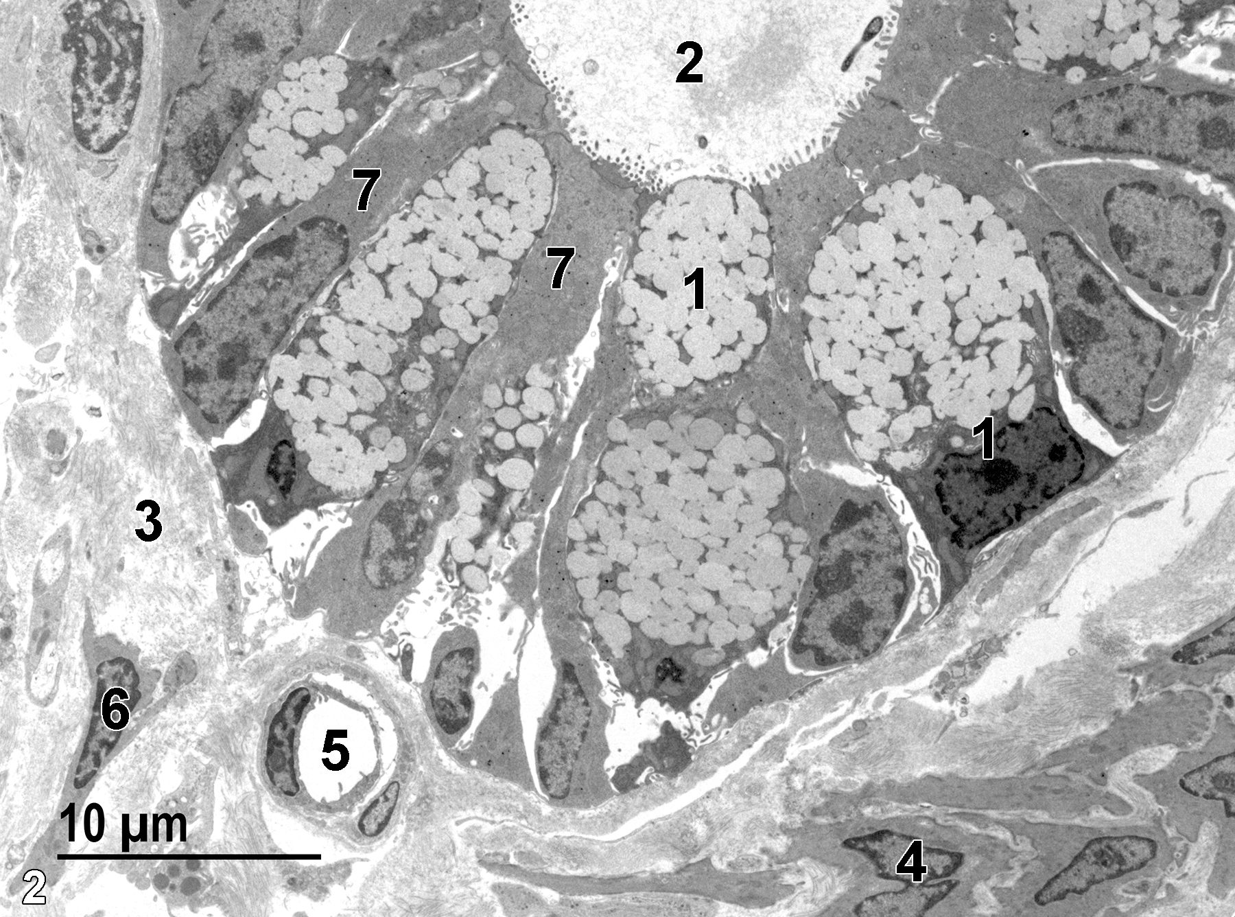<strong>Figure 2.</strong> The basal aspect of a crypt of Lieberkühn. The lumen (2) of the crypt is lined with absorptive epithelial cells (7) with microvilli at the luminal surface and mucous cells (1) with no microvilli and containing numerous mucous droplets. The lamina propria (3) has bundles of collagen fibrils, a capillary (5), and occasional fibroblasts (6). A layer of smooth muscle cells, the muscularis mucosae (4), forms a layer below the lamina propria. 2900x.