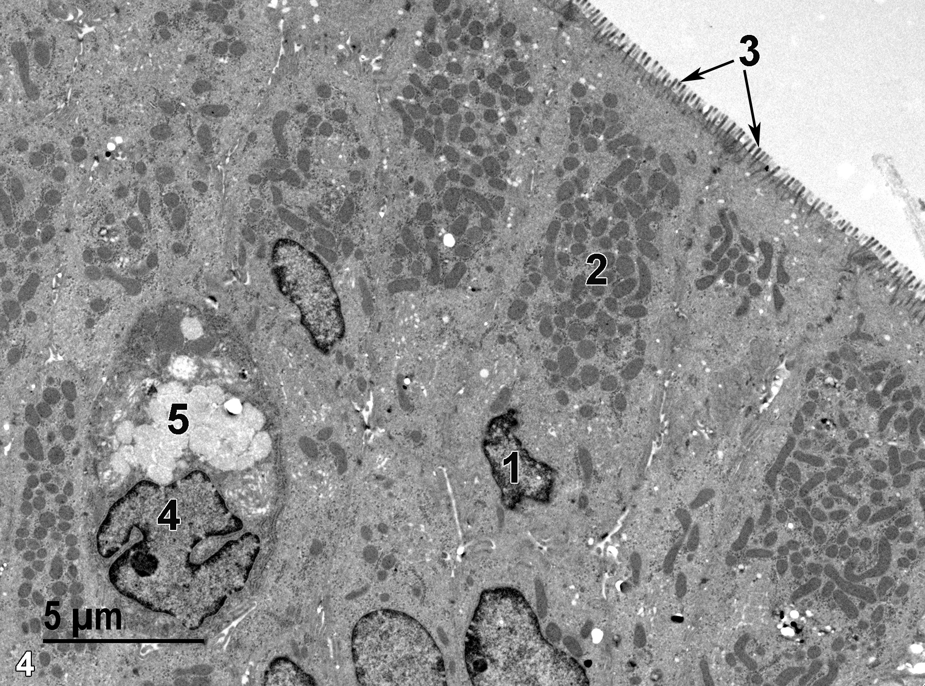 <strong>Figure 4.</strong> A portion of the colonic mucosal epithelium. An absorptive epithelial cell has a basal nucleus (1), a large number of more apical mitochondria (2) and numerous microvilli (3, arrows) that extend into the colon lumen. A mucous cell is shown with a single nucleus (4) and a cluster of mucous droplets (5). 4800x.