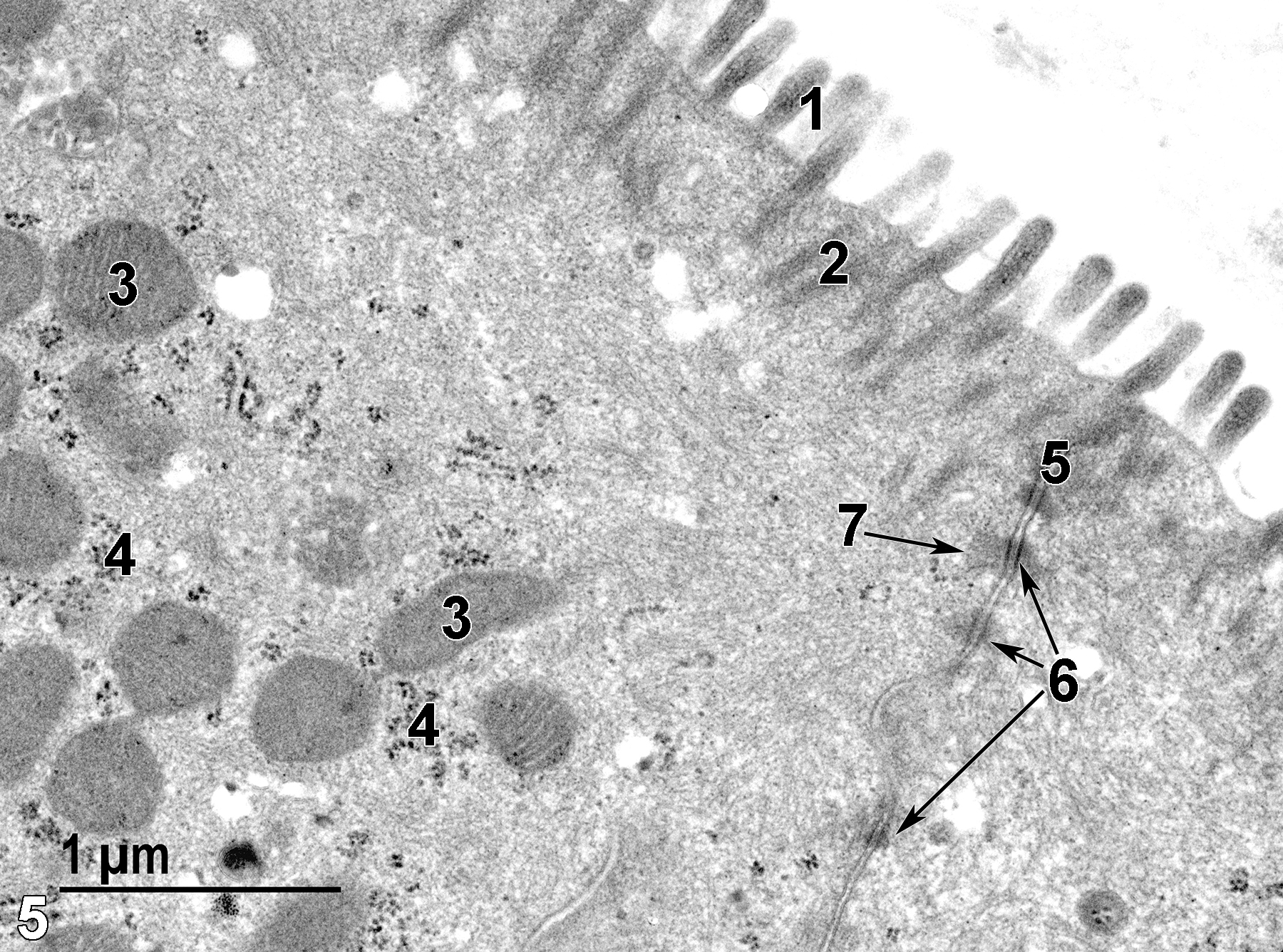 <strong>Figure 5.</strong> A high magnification view of two absorptive epithelial cells. The cell surface has microvilli (1) that protrude into the colon lumen and has bundles of proteinaceous fibrils that extend into the cytoplasm, forming the rootlets (2) of the microvilli. Mitochondria (3) are present primarily in the apical aspect of these cells. Clusters of free ribosomes (4) are common. A junctional complex (5) binds the apical aspect of the epithelial cells to each other. Desmosomes (6, arrows) with associated tonofilaments (7, arrow) are part of the junctional complex. 30000x.