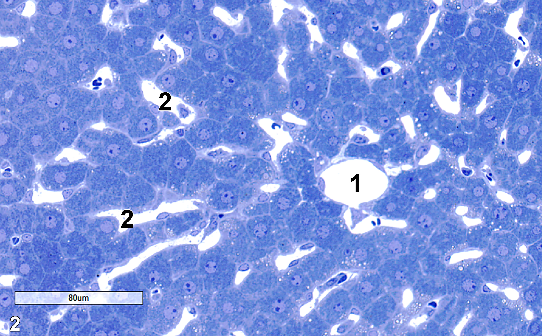 <strong>Figure 2.</strong> A toluidine blue O-stained semithin section showing the central vein (1) of a liver lobule, with sinusoids (2) generally oriented toward the central vein. The sinusoids contain erythrocytes, leukocytes, Kupffer cells, and have Ito cells just outside the sinusoids in the space of Disse. 25x.