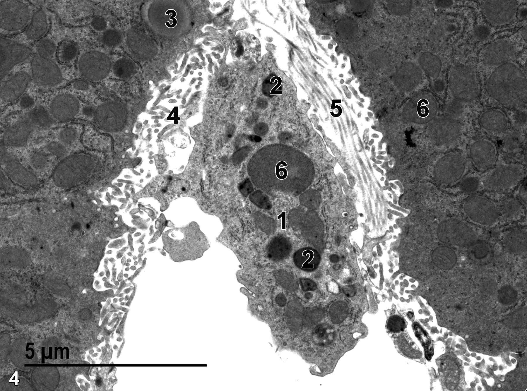 <strong>Figure 4.</strong> A higher magnification view of the Kupffer cell (1) seen in Figure 3 shows mitochondria (6) in the Kupffer cell and an adjacent hepatocyte. Lysosomes (2) in the Kupffer cell are round and more electron dense than the mitochondria. A lipid droplet (3) is located in one of the hepatocytes. The microvillous surfaces (4) of hepatocytes adjacent to the space of Disse are evident. Bundles of collagenous fibrils (5) that show diagnostic banding patterns in some areas are present. 9300x.