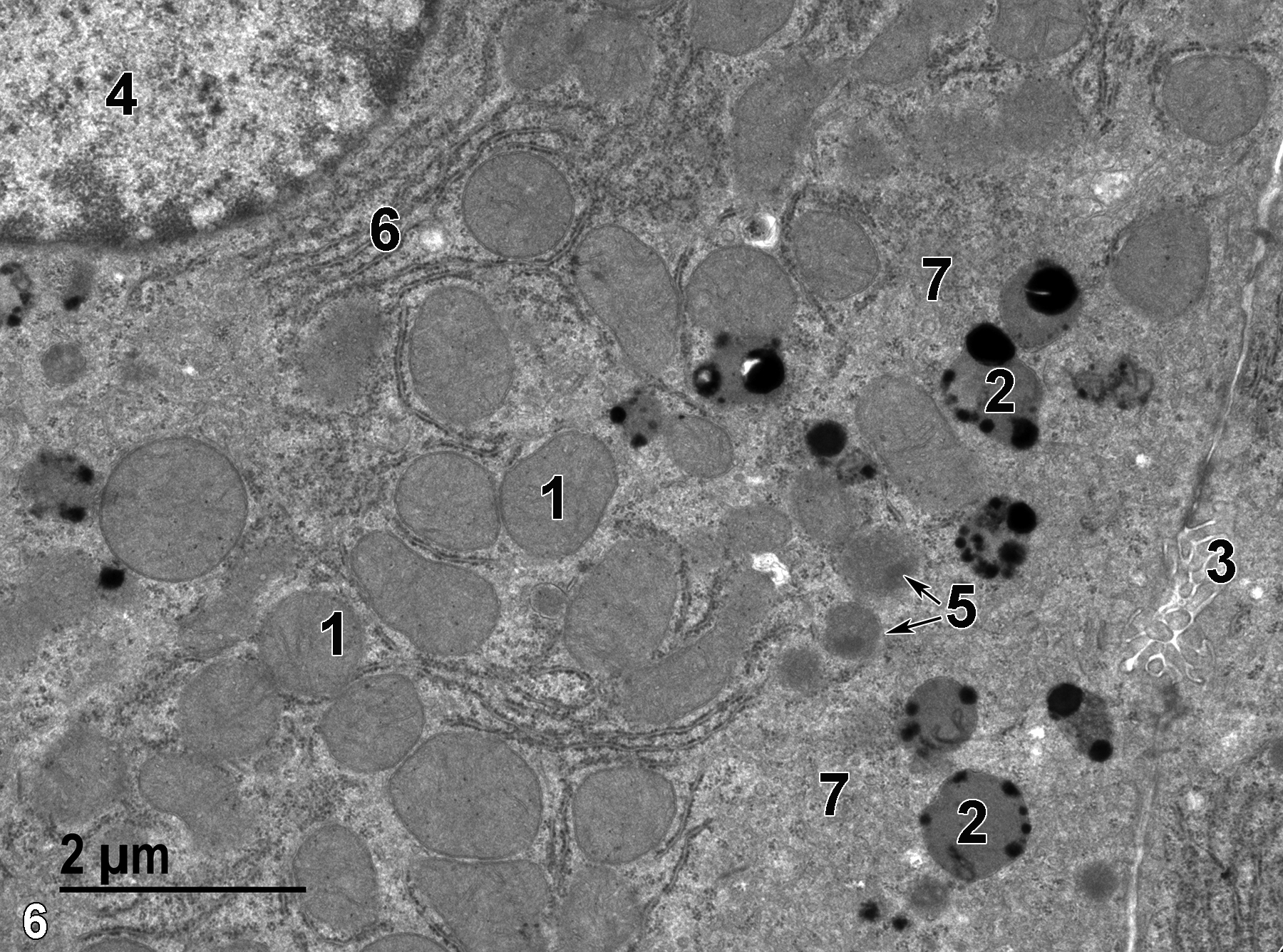 <strong>Figure 6.</strong> Some hepatocytes containing prominent lysosomes (2) with extremely electron-dense contents, along with mitochondria (1) that are often associated with peri-mitochondrial rough endoplasmic reticulum elements. A bile canaliculus (3) with microvilli projecting from adjacent hepatocytes is shown on the far right in the image. The round nucleus (4) with marginated heterochromatin has an associated stack of rough endoplasmic reticulum (6). Two peroxisomes with electron-dense paracrystalline inclusions (5, arrows) are shown. Areas with vesicular profiles (7) are consistent with smooth endoplasmic reticulum. 13000x.