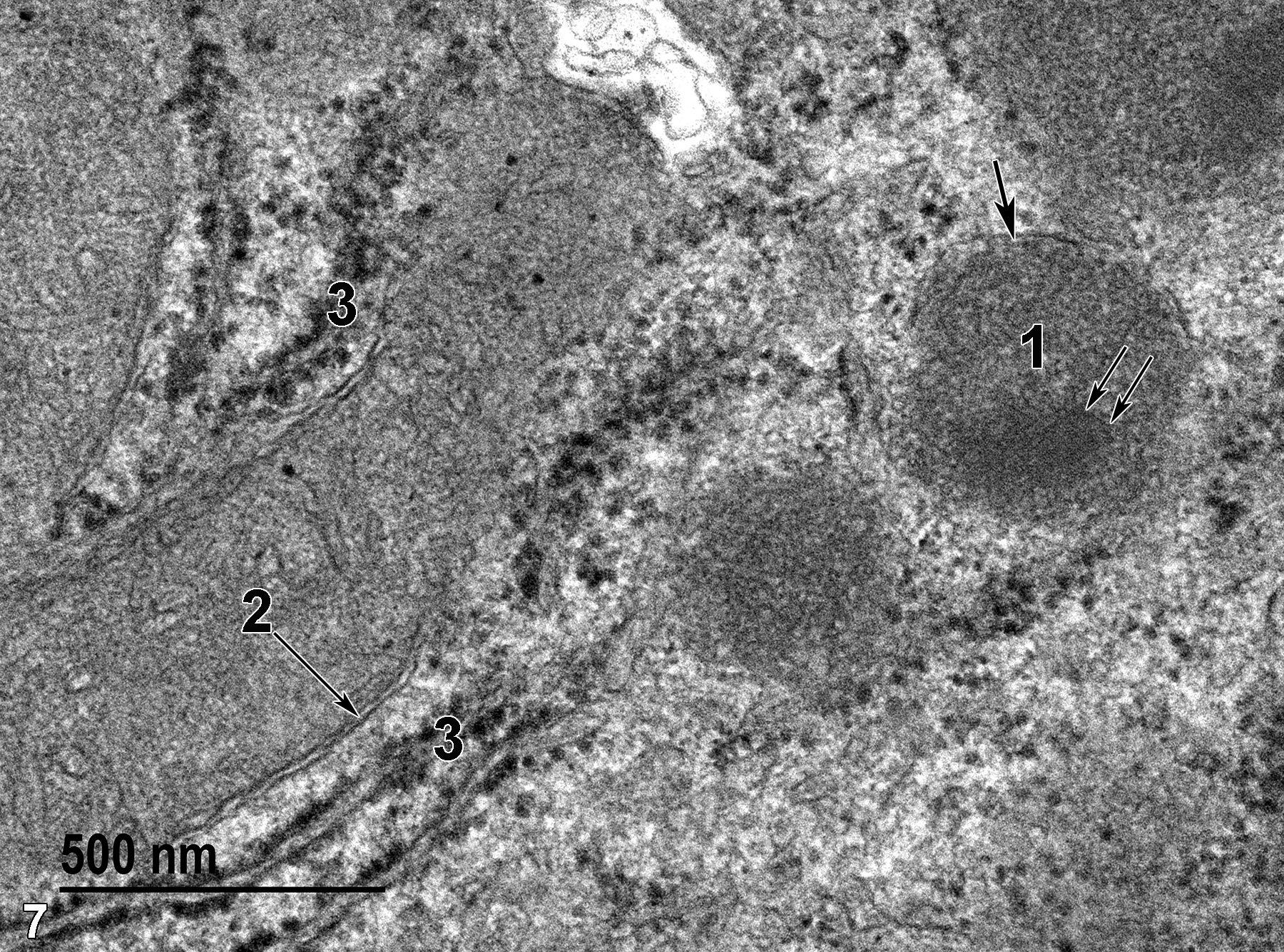 <strong>Figure 7.</strong> A high magnification view of structures within a hepatocyte. A mitochondrion with a double membrane-bound border (2, arrow) is easily distinguished from the somewhat more electron-dense peroxisome that has a single membrane-bound border (1, thick arrow) and a paracrystalline array (1, thin arrows). Rough endoplasmic reticulum elements (3) with their ribosomal covering are seen adjacent to the mitochondria. 68000x.