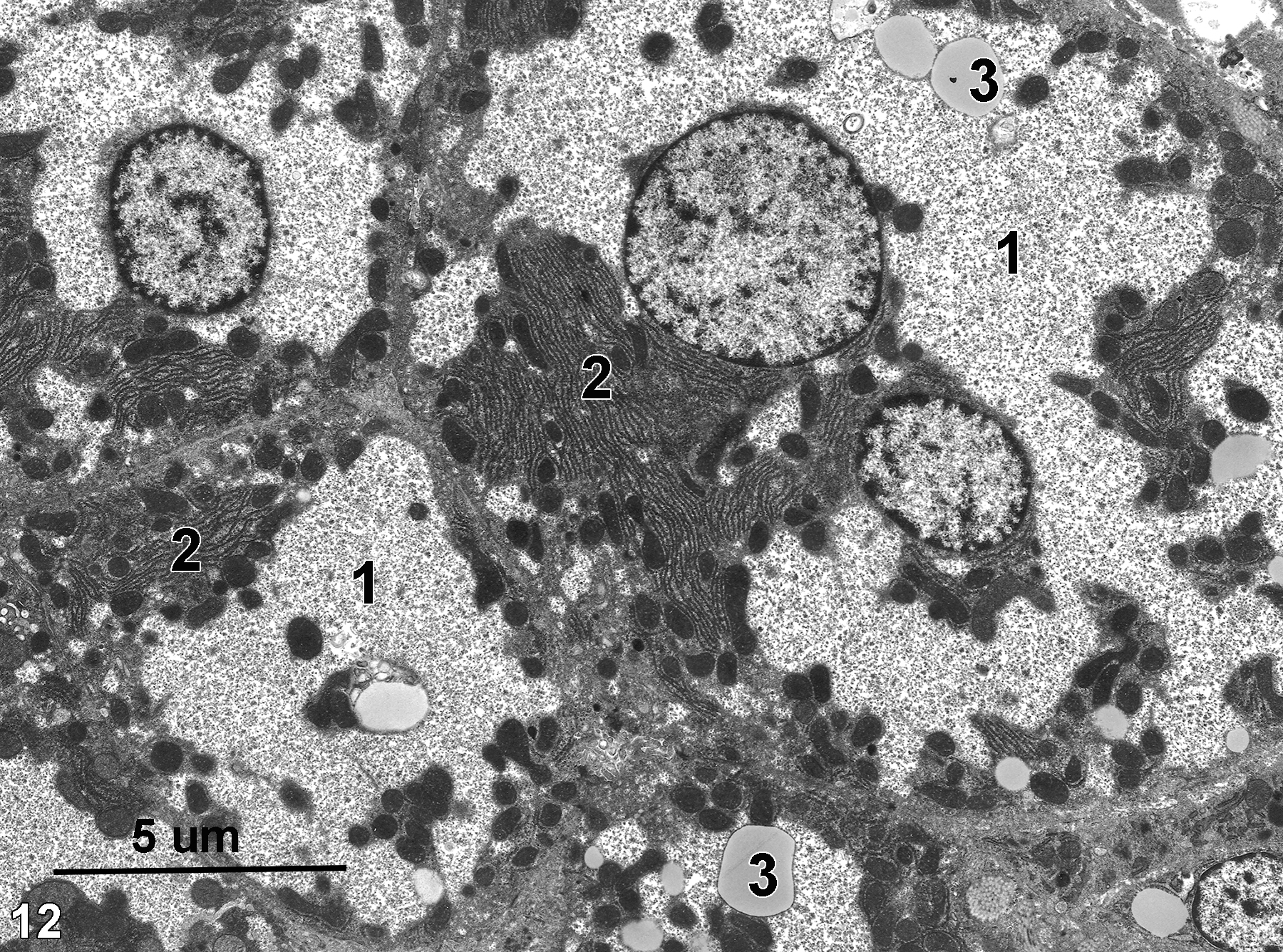 <strong>Figure 12.</strong> Hepatocytes from a well-fed rat. A large proportion of the hepatocyte cytoplasm consists of glycogen lakes (1). The granular glycogen deposits have pushed the stacks of rough endoplasmic reticulum and mitochondria (2) to the margins of the hepatocytes. Lipid bodies (3) are also present in the glycogen lakes. Magnification not known.