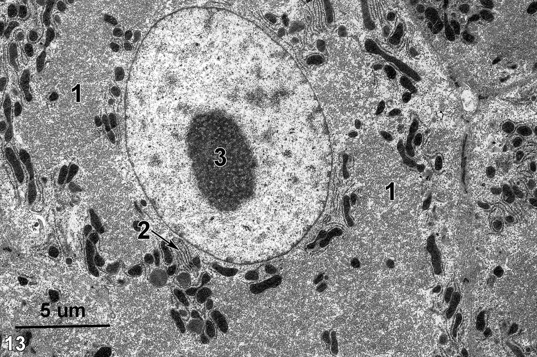 <strong>Figure 13.</strong> A hepatocyte with a typically round nucleus with a prominent nucleolus (3). A stack of rough endoplasmic reticulum (2, arrow) is seen in a perinuclear position. Mitochondria are mostly perinuclear or at the periphery of the cytoplasm due to the large amount of smooth endoplasmic reticulum (1) occupying the cytoplasm of this hypertrophied hepatocyte. Magnification not known.