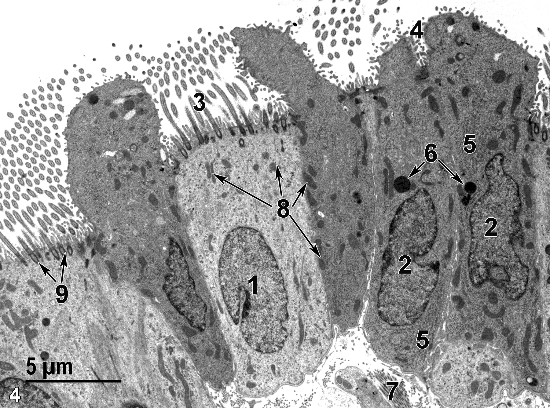 <strong>Figure 4.</strong> A higher magnification view of the bronchiolar epithelium. The nuclei of a ciliated cell (1) and of a club cell (2) are both located basally in the respective cells. Cilia (3) extend into the airway and are subtended by basal bodies at the apex of the ciliated cells (9, arrows). Microvilli are located between the cilia. The microvilli of club cells (4) are considerably shorter than those seen on the ciliated cells. Stacks of rough endoplasmic reticulum (5) and lysosomes (6, arrows) are visible in the club cells. Bundles of collagen (7) are directly below the epithelial cells. Mitochondria are scattered throughout the cytoplasm of both epithelial cell types (8, arrows). 4800x.
