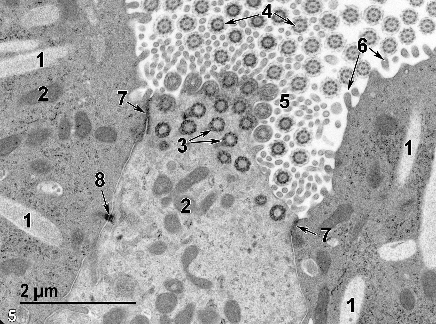 <strong>Figure 5.</strong> An even higher magnification of the bronchiolar epithelial cells. Secretory granules (1) of the club cells are elongated and have fine granular contents. Mitochondria (2) are relatively electron dense and variable in size and shape. Ciliary basal bodies are seen in cross section (3, arrows), as are the cilia in the airway (4, arrows). Cross sections of ciliary cell microvilli (5) are present as well. Only microvilli are present on the surface of club cells (6, arrows). Junctional complexes are located between adjacent epithelial cells extending to the luminal surface of the airway (7, arrow). At the base of a junctional complex is a desmosome with associated proteinaceous filaments (8, arrow). 18500x.