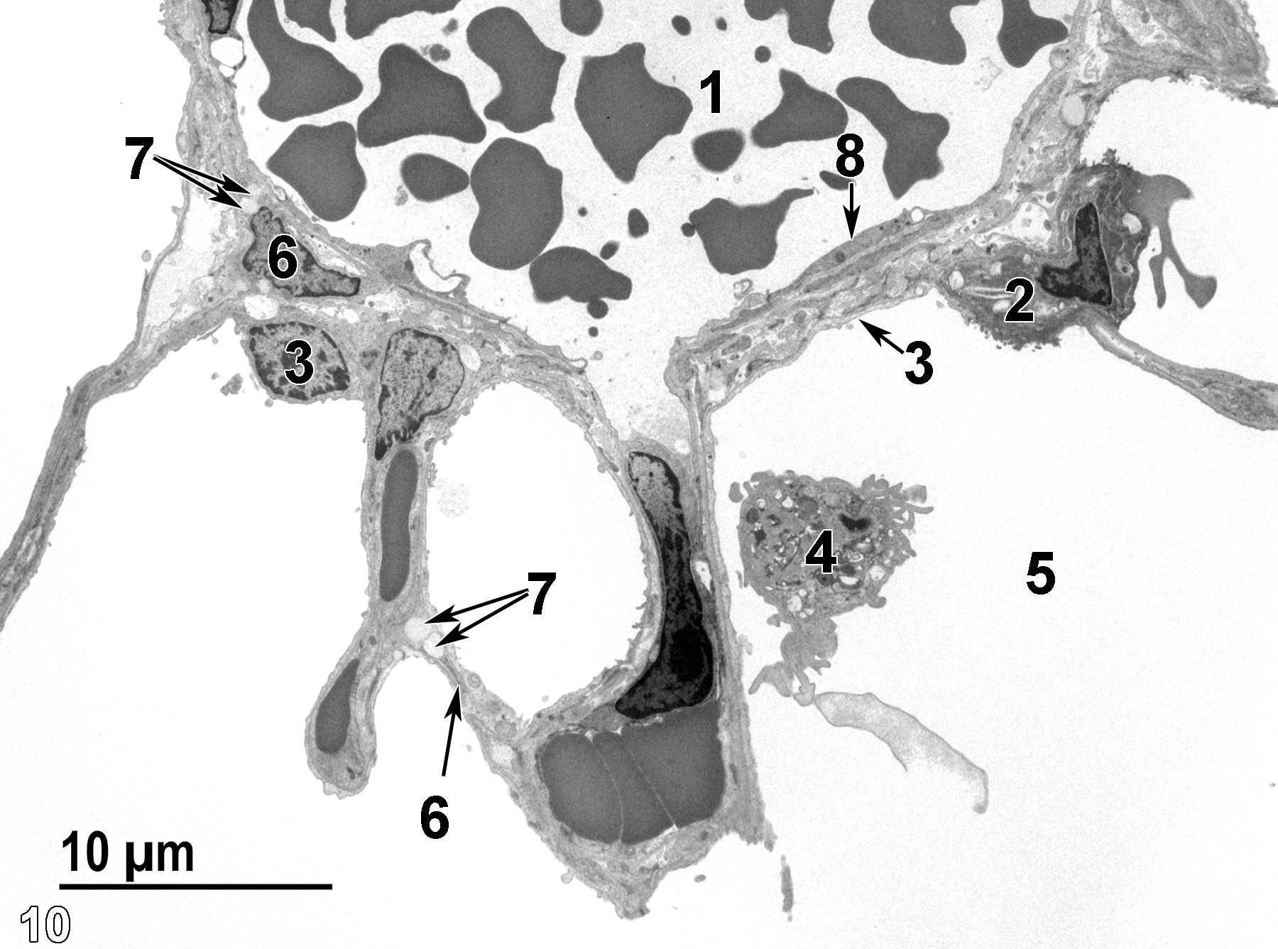 <strong>Figure 10.</strong> Another view of alveolar structure, with a blood vessel (1) with erythrocytes lined with a thin layer of endothelial cells (8, arrow). A type II cell (2) with a thin type I cell (3, arrow) are present. A pulmonary macrophage (4) is located in the airway (5). Occasional lipofibroblasts (6) are identified by the presence of lipid bodies (7, arrows). 2900x.